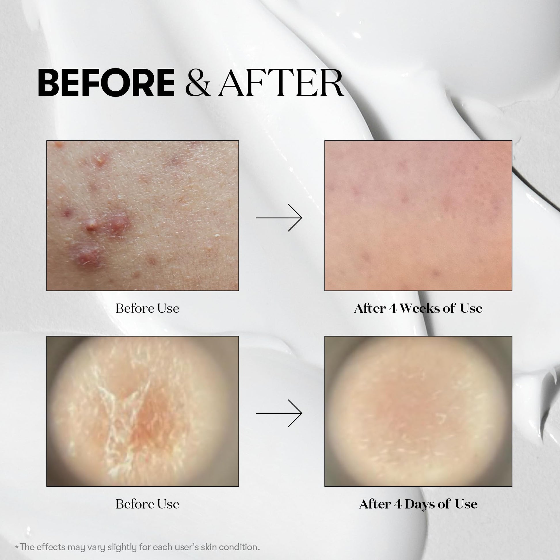 VT COSMETICS CICA Reedle Shot 100, suero de microagujas para uso diario y nocturno con exosomas, centella asiática, ácido hialurónico, propóleo, piel suave, regeneración, piel de cristal, potenciad