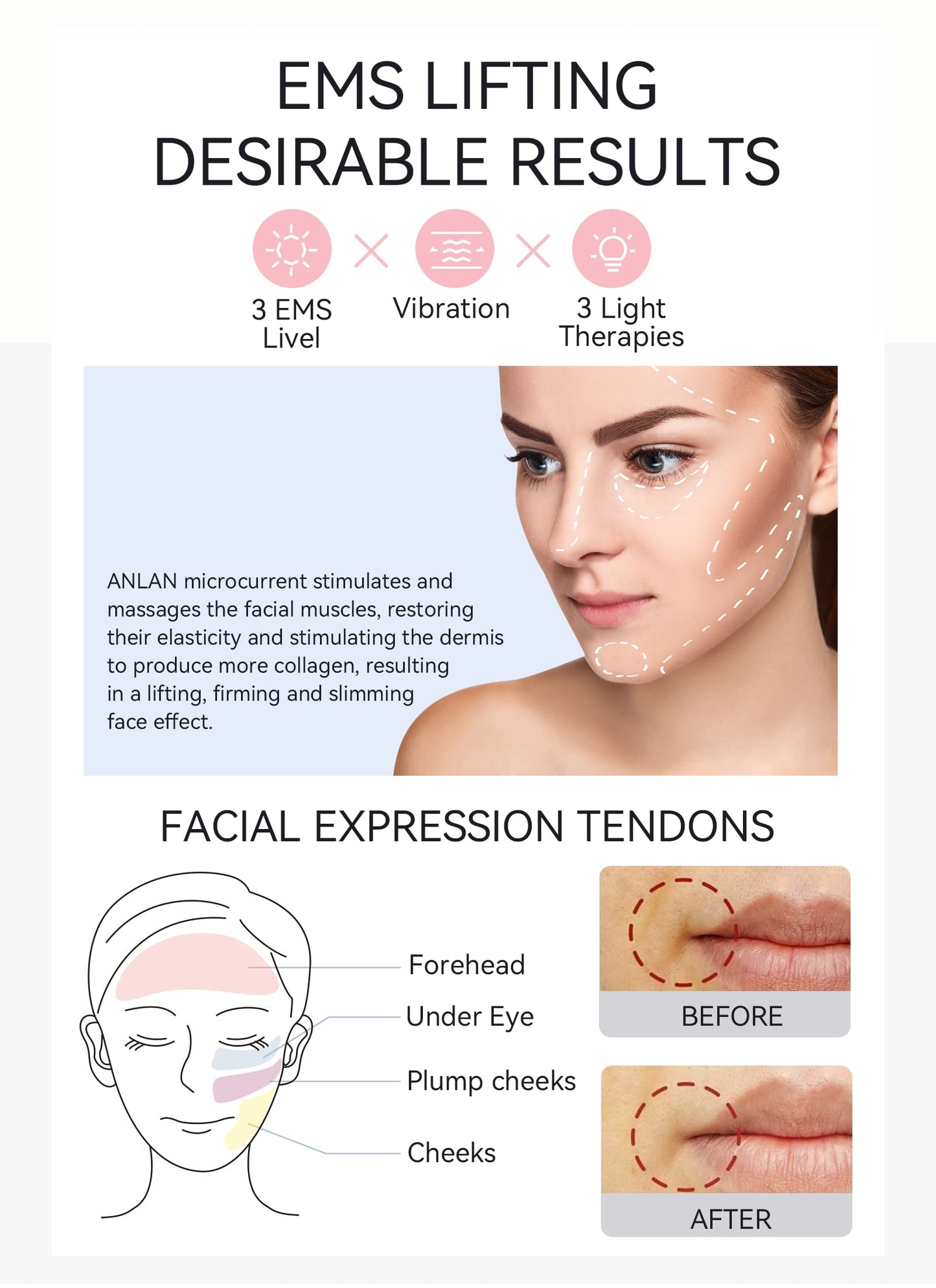 Masajeador Facial ANLAN Blanco 5EN1 Pro Antienvejecimiento para Mujer