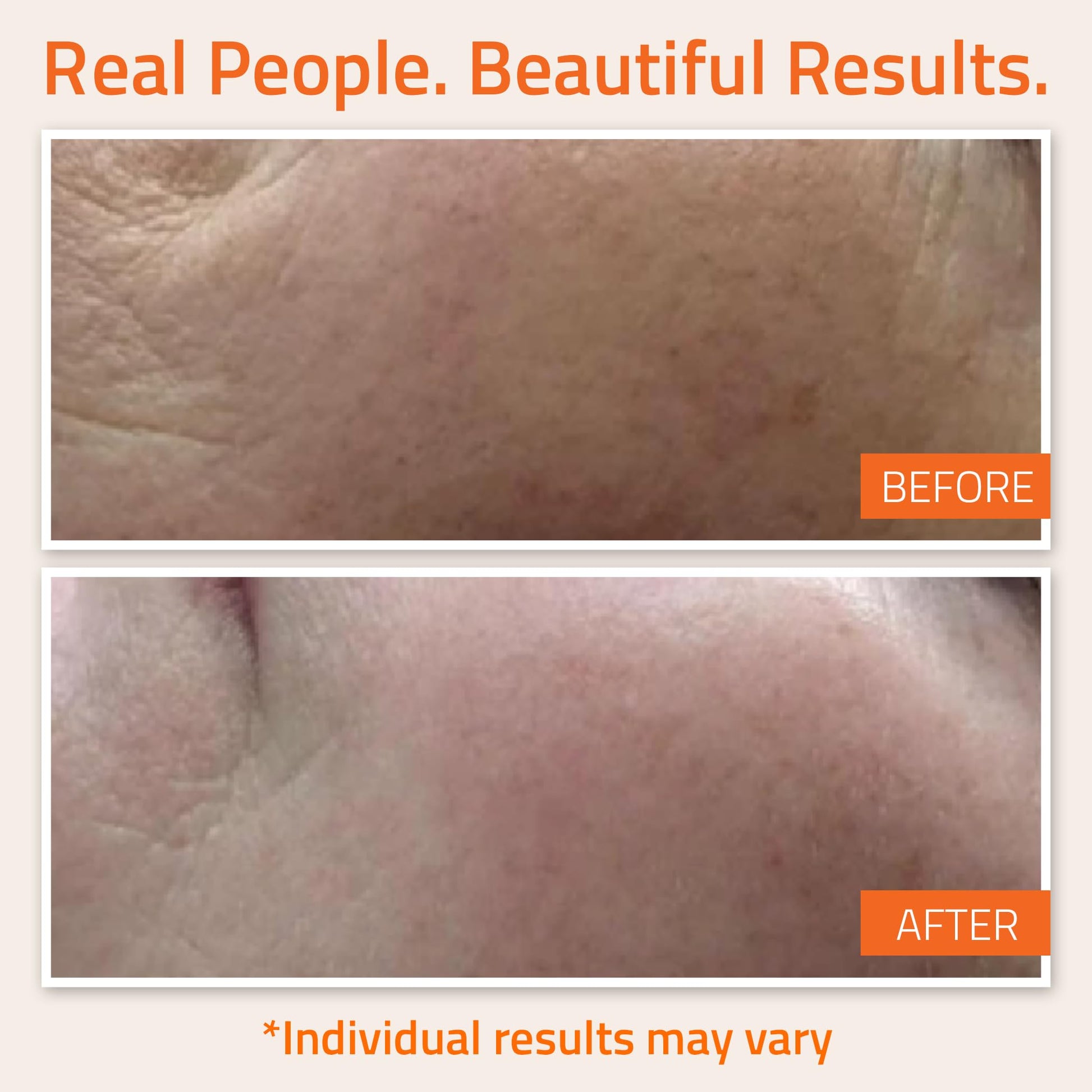 YEOUTH Suero Facial de Vitamina C con Ácido Hialurónico y Vitamina E, Vegano, Suero Antimanchas y Antiarrugas para el Rostro, Apto para Dermaroller, Combo con Hidratante Crema Solar Facial 30ml