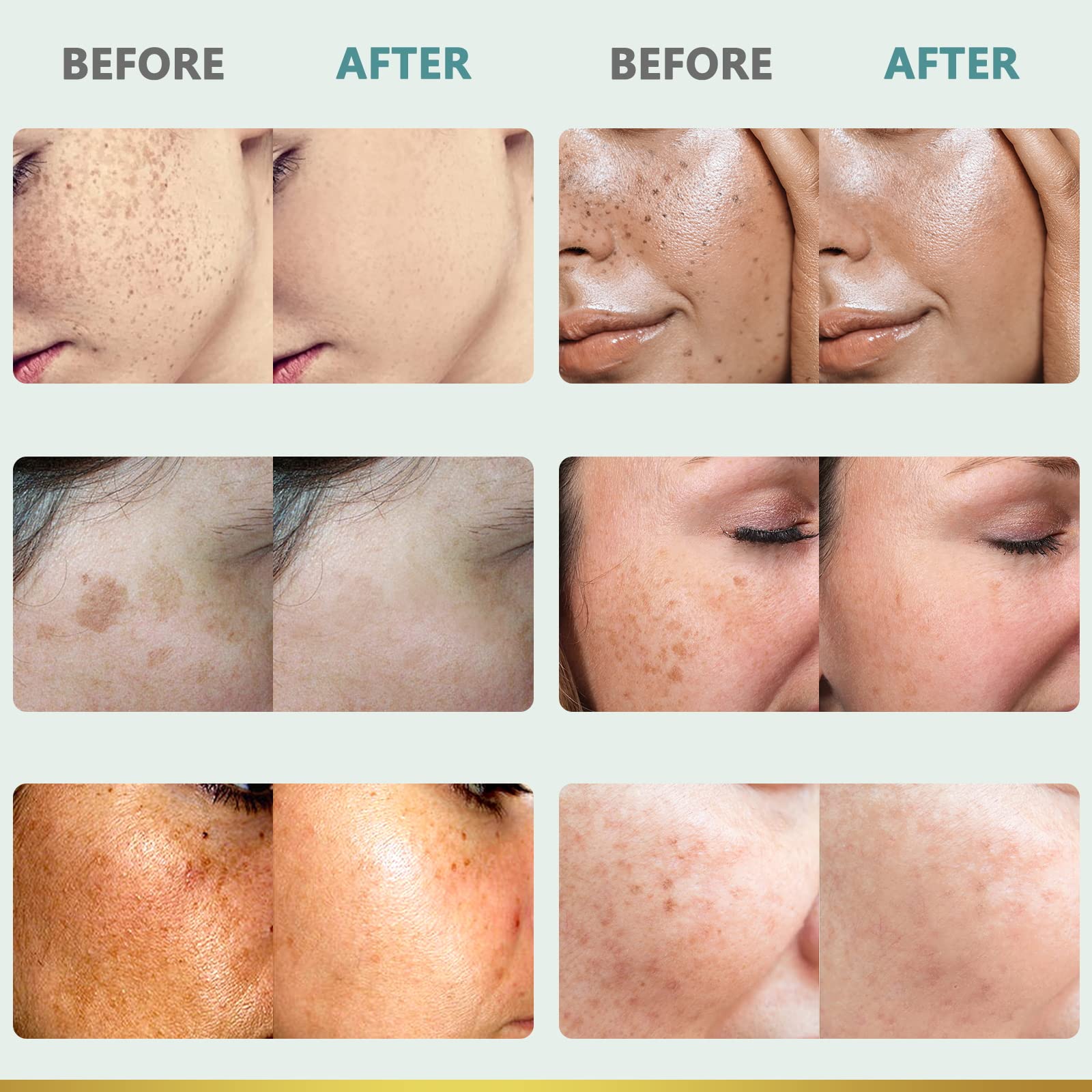 CITYGOO - Eliminador de manchas oscuras para el rostro y cuerpo: crema correctora de manchas oscuras con ingredientes naturales y efectivos para una piel radiante