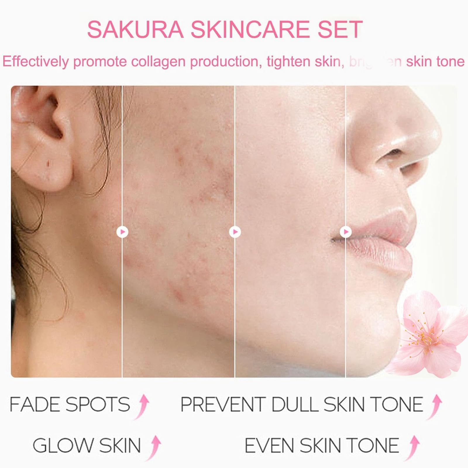 LAIKME- Kit de cuidado de la piel Sakura Skin Care Set Facial Kit, cuidado de la piel con flores de cerezo para adolescentes, juego de regalo completo para el cuidado de la piel Cre