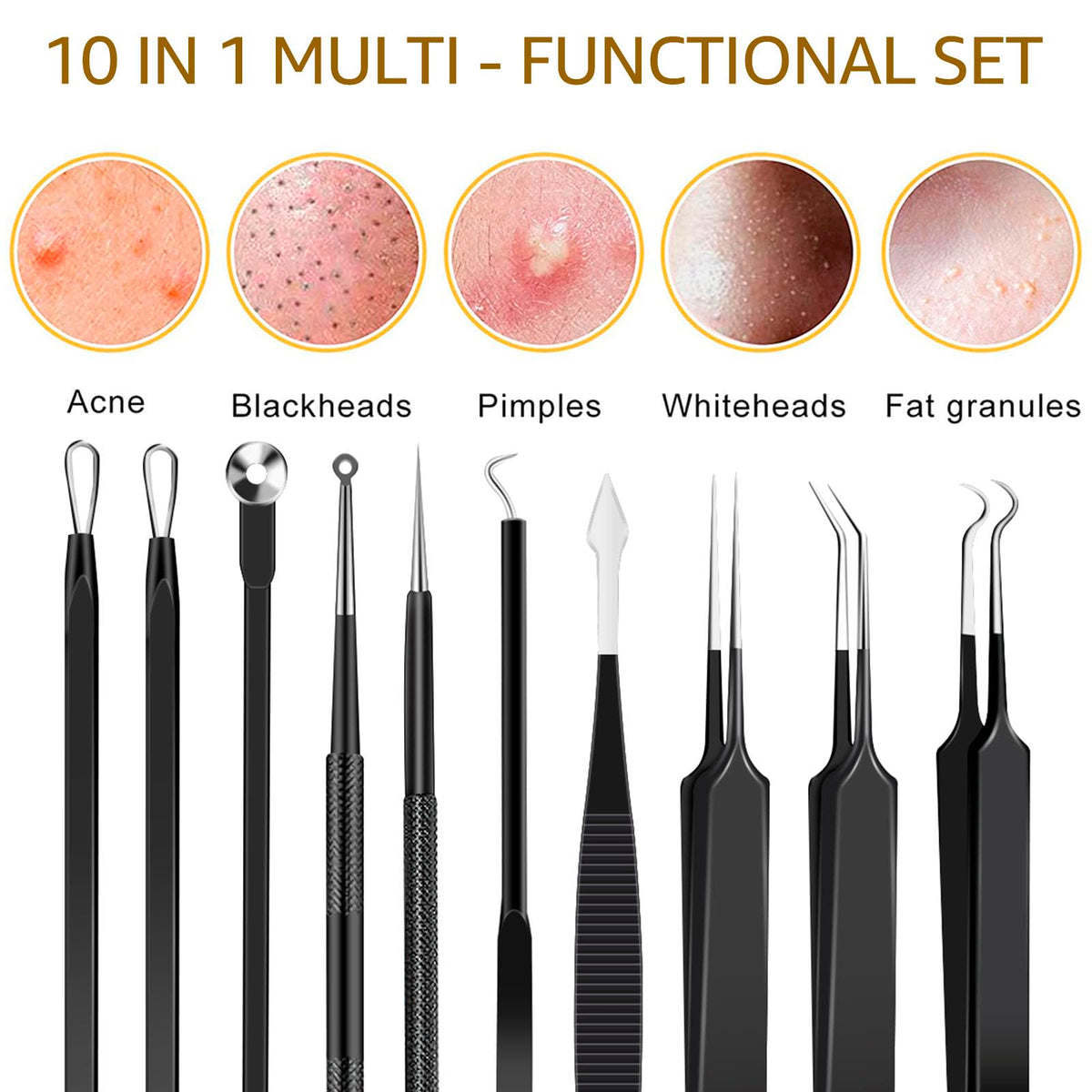 40 piezas de herramientas de popotón de espinillas de acero inoxidable, extractor de comedones para frente, nariz, herramienta ligera de aguja de acné con caja de metal para viajes en el hogar