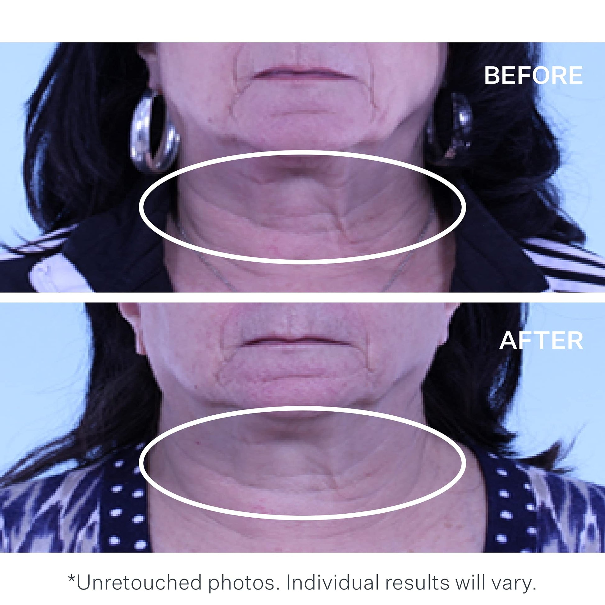 Strivectin Tightening neck serum roller