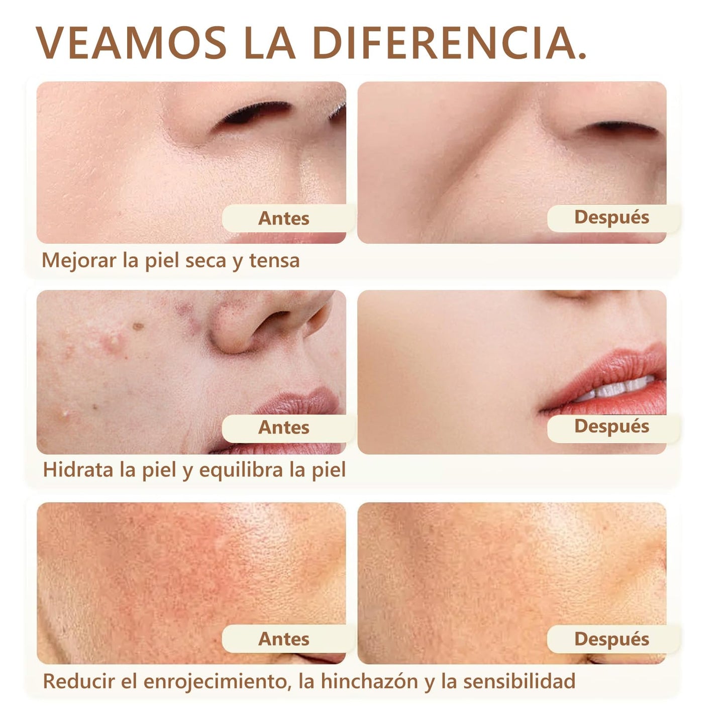 Crema de Cebo de Res con Balsamo de Miel: Sebo de Res Sebo de Res para La Cara-Crema Facial con Acabado de Pasto de Animales Alimentados con Pasto,Cuidado de La Piel Profundamente Nutritiv 2 Botellas