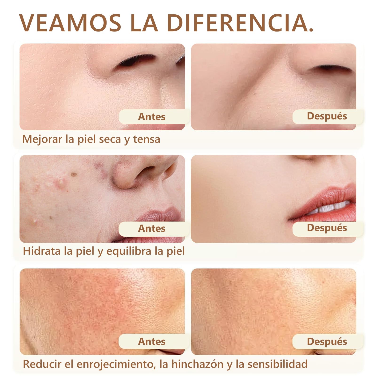 Crema de Cebo de Res con Balsamo de Miel: Sebo de Res Sebo de Res para La Cara-Crema Facial con Acabado de Pasto de Animales Alimentados con Pasto,Cuidado de La Piel Profundamente Nutritiv 2 Botellas