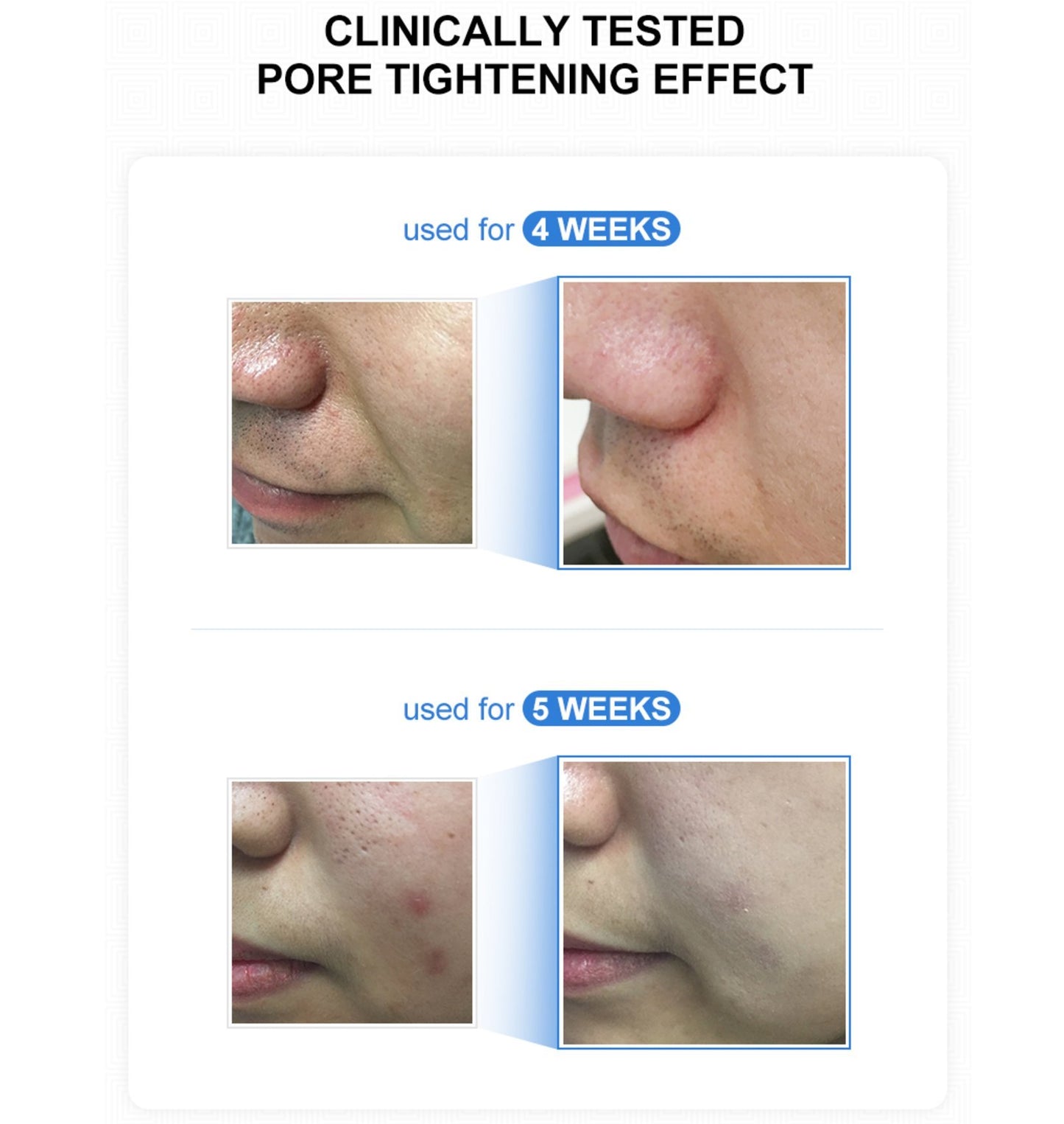 Medicube Zero Pore Serum 27 ml