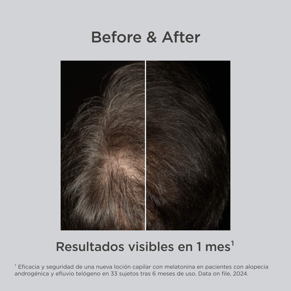 Loción Spray Anticaída Isdin Lambdapil Melatonina 100 Ml para Reforzar el Cabello