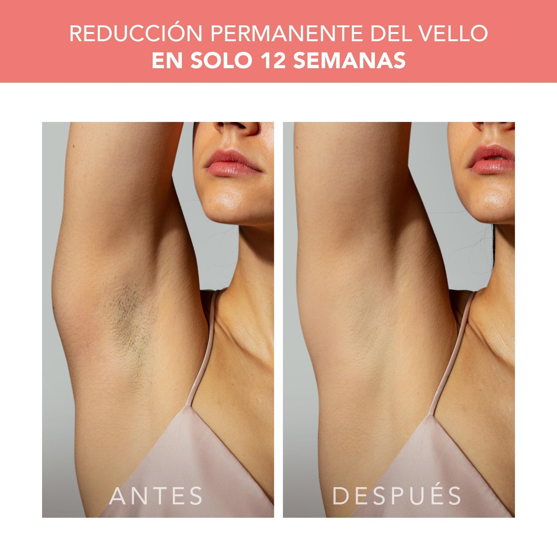 FOREO PEACH 2 – Depiladora luz pulsada IPL rostro y cuerpo – Tecnología láser depilación en casa – Incluye gel refrescante conductor preparación piel – Con enfriamiento y escudo silicona