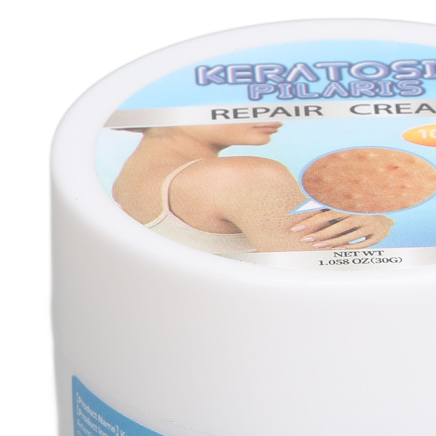 Crema de Queratosis para Suavizar la Piel, Borrador de Protuberancias, Exfoliación con Vitamina E - Solución Diaria para el Cuidado de la Piel, Material Orgánico, Alivio