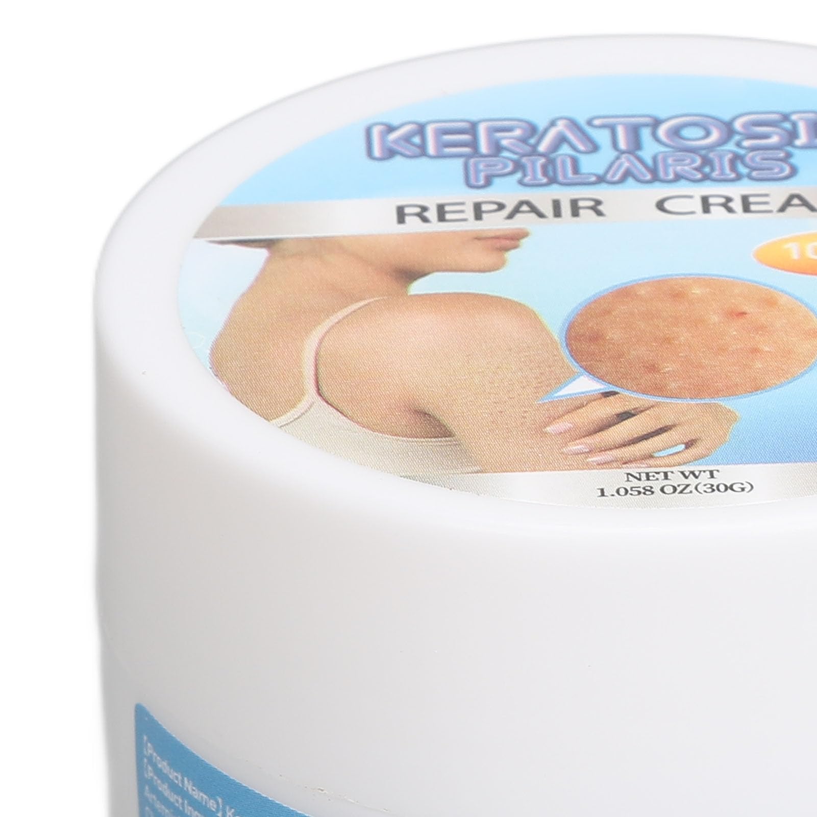 Crema de Queratosis para Suavizar la Piel, Borrador de Protuberancias, Exfoliación con Vitamina E - Solución Diaria para el Cuidado de la Piel, Material Orgánico, Alivio