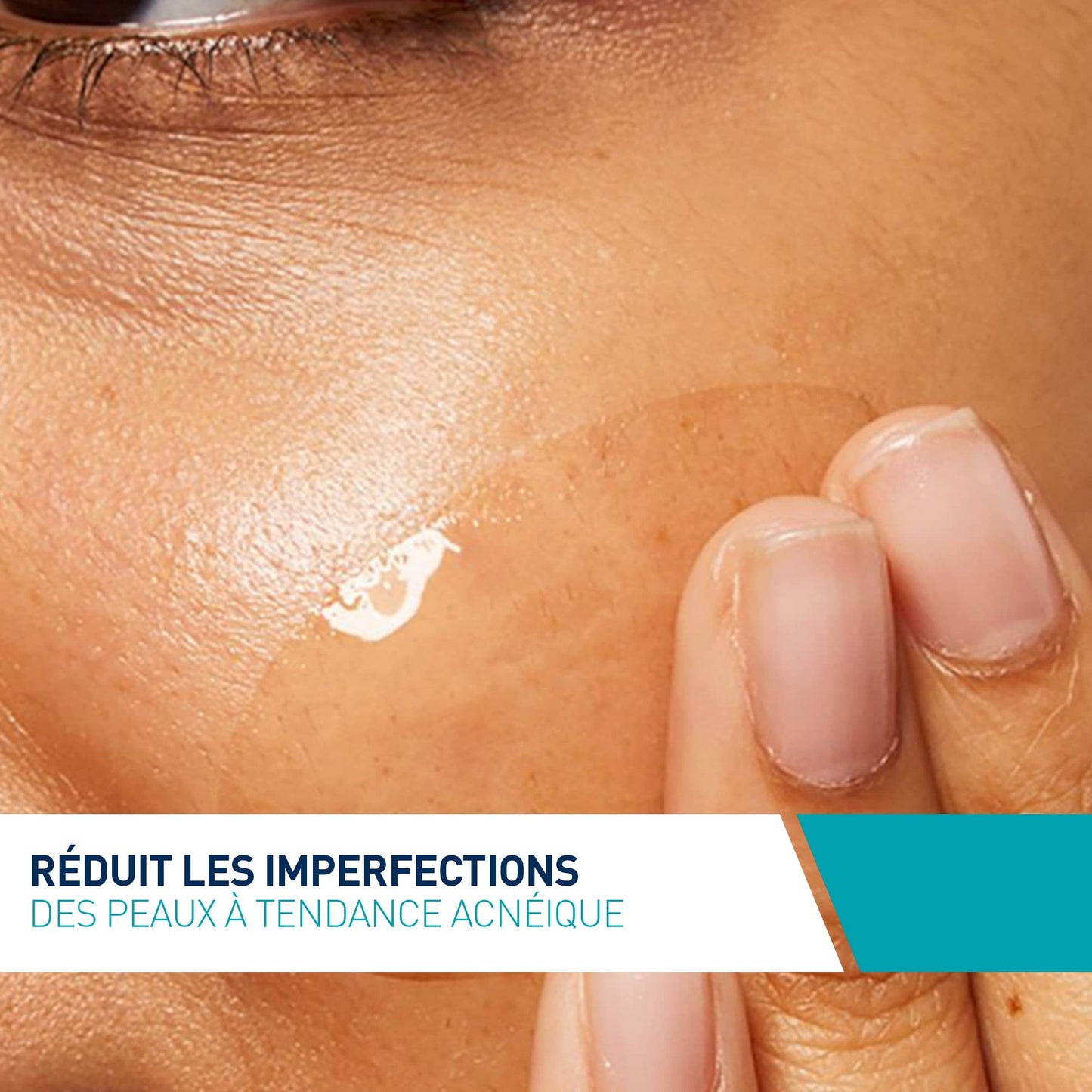 Cerave. Gel Facial tratamiento Anti-imperfecciones Para Piel Grasa o Acne, 40ml + Serum Retinol Anti-Marcas Para Piel Grasa o Acne, 30ml