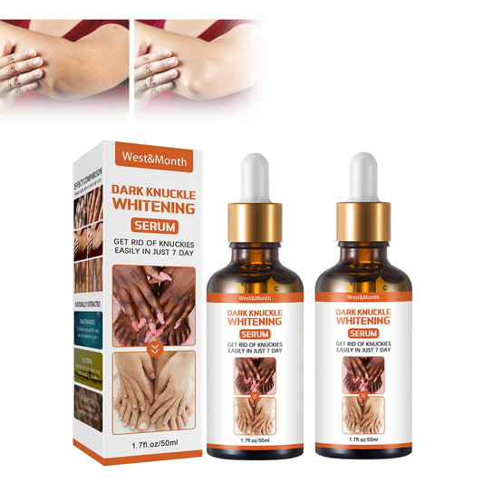 Tratamiento corporal para Acantosis Nigricans y manchas oscuras con blanqueamiento para codos y rodillas. ¡Corrige e ilumina tu piel!