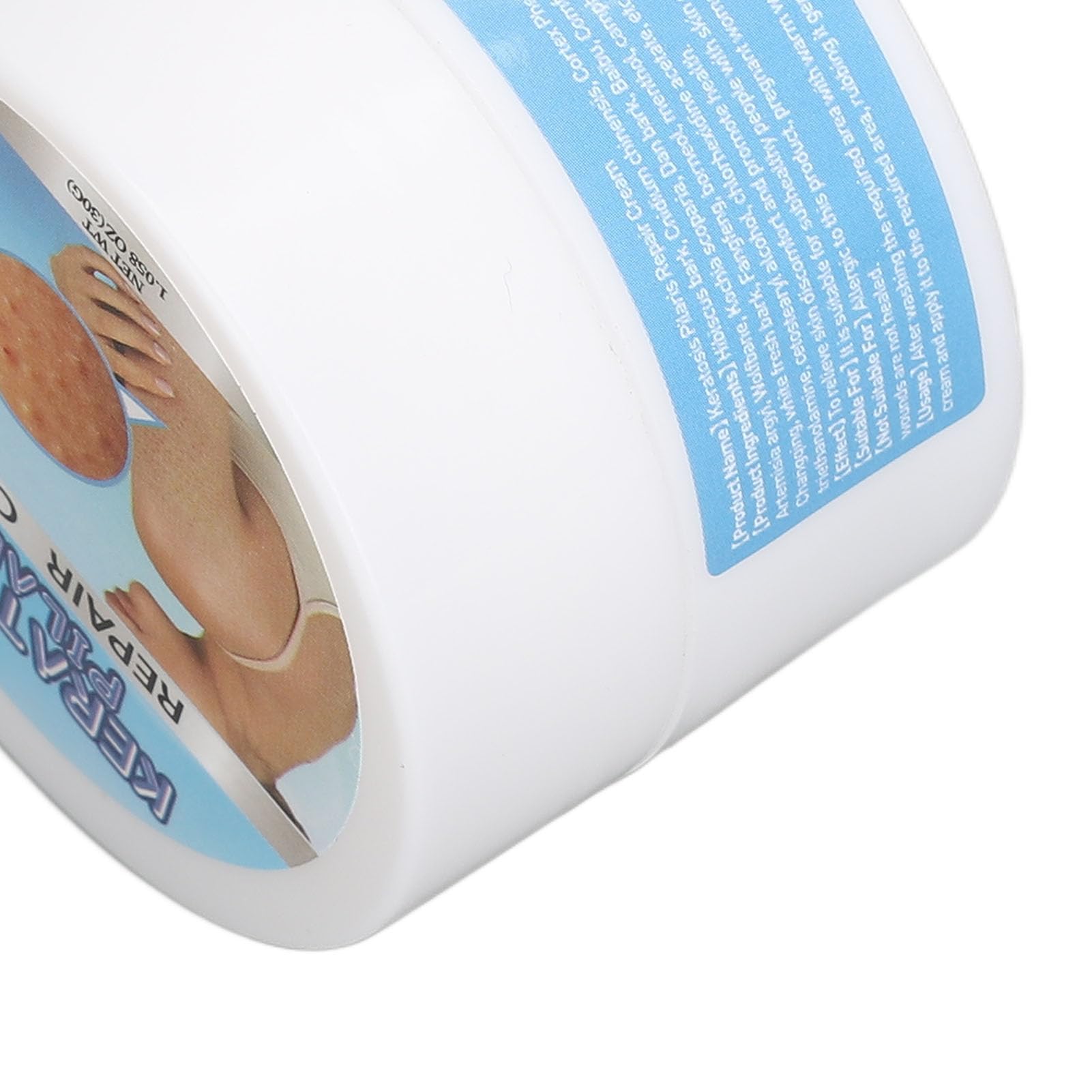 Crema de Queratosis para Suavizar la Piel, Borrador de Protuberancias, Exfoliación con Vitamina E - Solución Diaria para el Cuidado de la Piel, Material Orgánico, Alivio