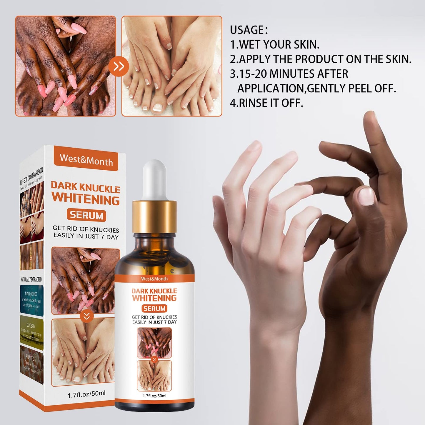 Serum Aclarador de Piel con Antioxidantes y Vitaminas para Codos y Rodillas - Tratamiento Natural - Corrige Acanthosis Nigricans