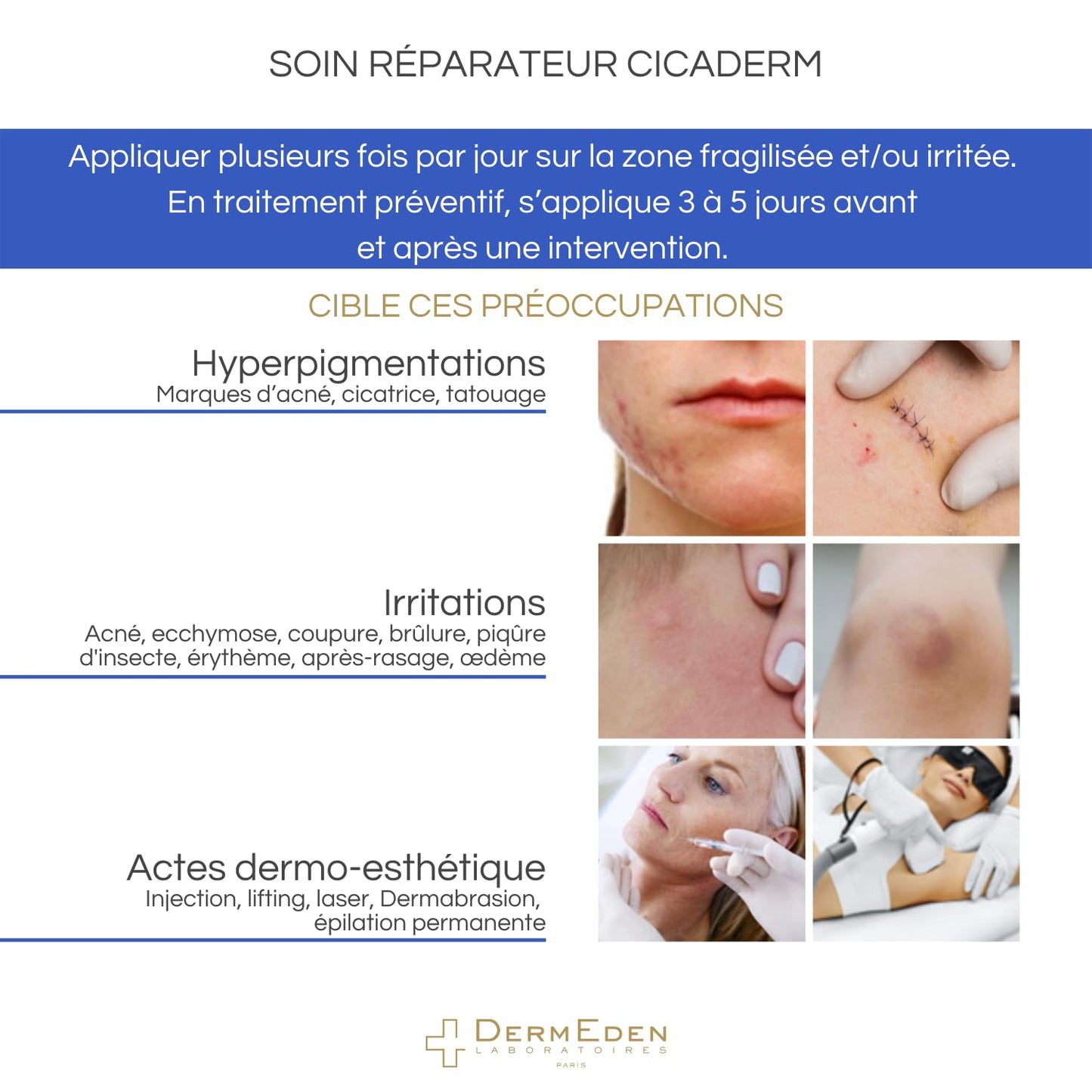 Tratamiento Reparador De La Piel 30 Ml (Dermeden)