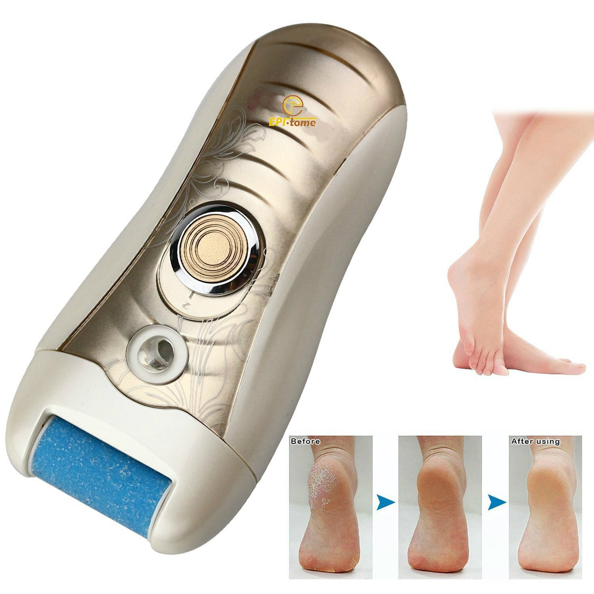 Epitome 3 in 1 Lady Wet or Dry Rechargeable Hair Removal Kit (Trimmer, Hair Epilator, Callus Remover) with 2 Mode Power Switch, LED Hair Shaver for Arm, Underarm & Legs (Gold)