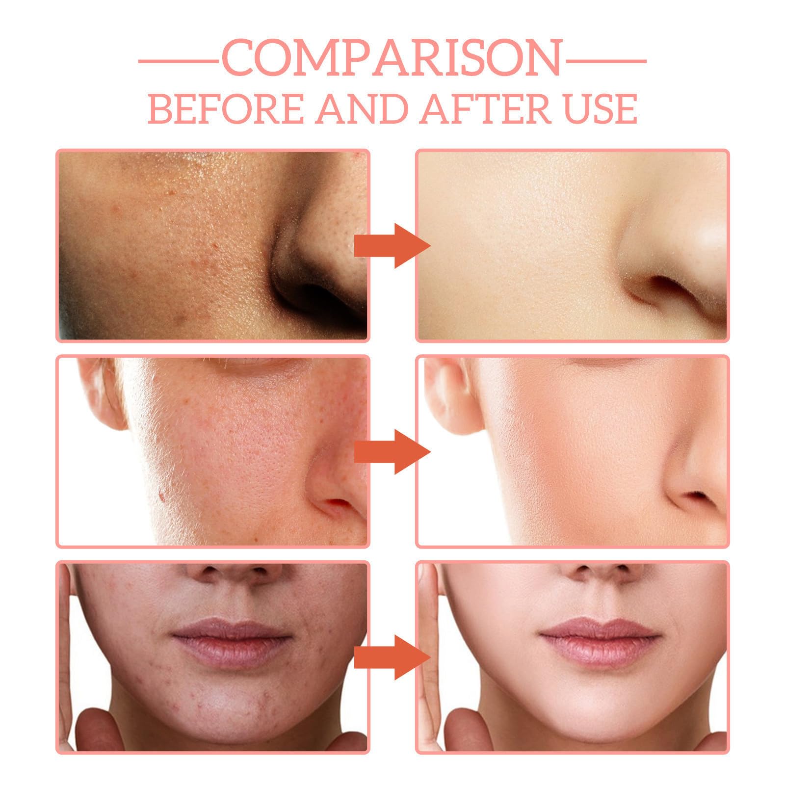 Set de Sueros Faciales Hidratantes con Vitamina C, Ácido Hialurónico, Niacinamida y Colágeno - Rejuvenece e Hidrata todo Tipo de Piel.