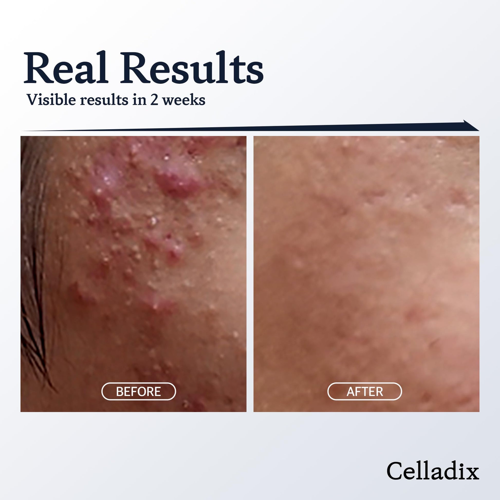 Grehge alancing Rx 131 Ampoule | Minimize Sebum | Tighten Enlarged Pores | Repair Skin Barrier | Rapid Soothing for Daily Use | Oily & Combination Skin | 0.68 Fl Oz