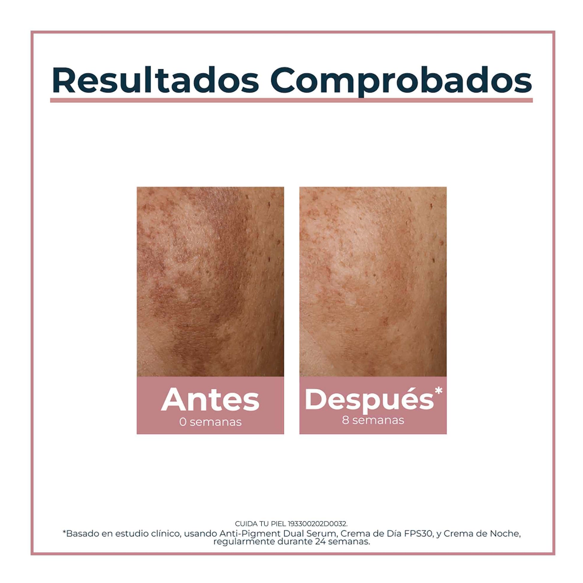 Serum Facial Eucerin Anti Pigmento 30ml