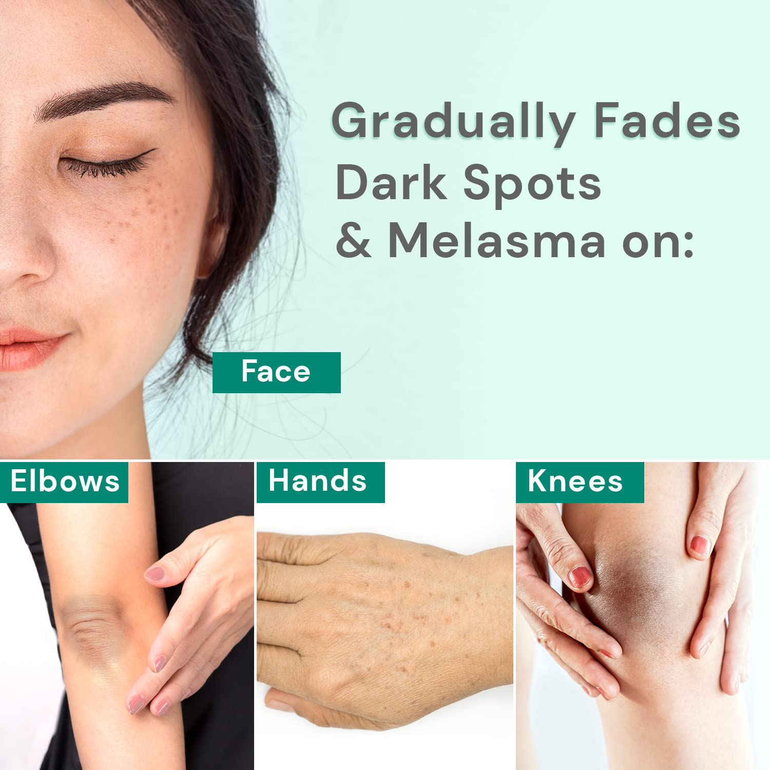 Ebanel Removedor de manchas oscuras para suero facial aclarador de la piel corrector de manchas oscuras para tratamiento de melasma e hiperpigmentación con ácido azelaico, ácido kójico, alfa arbutina