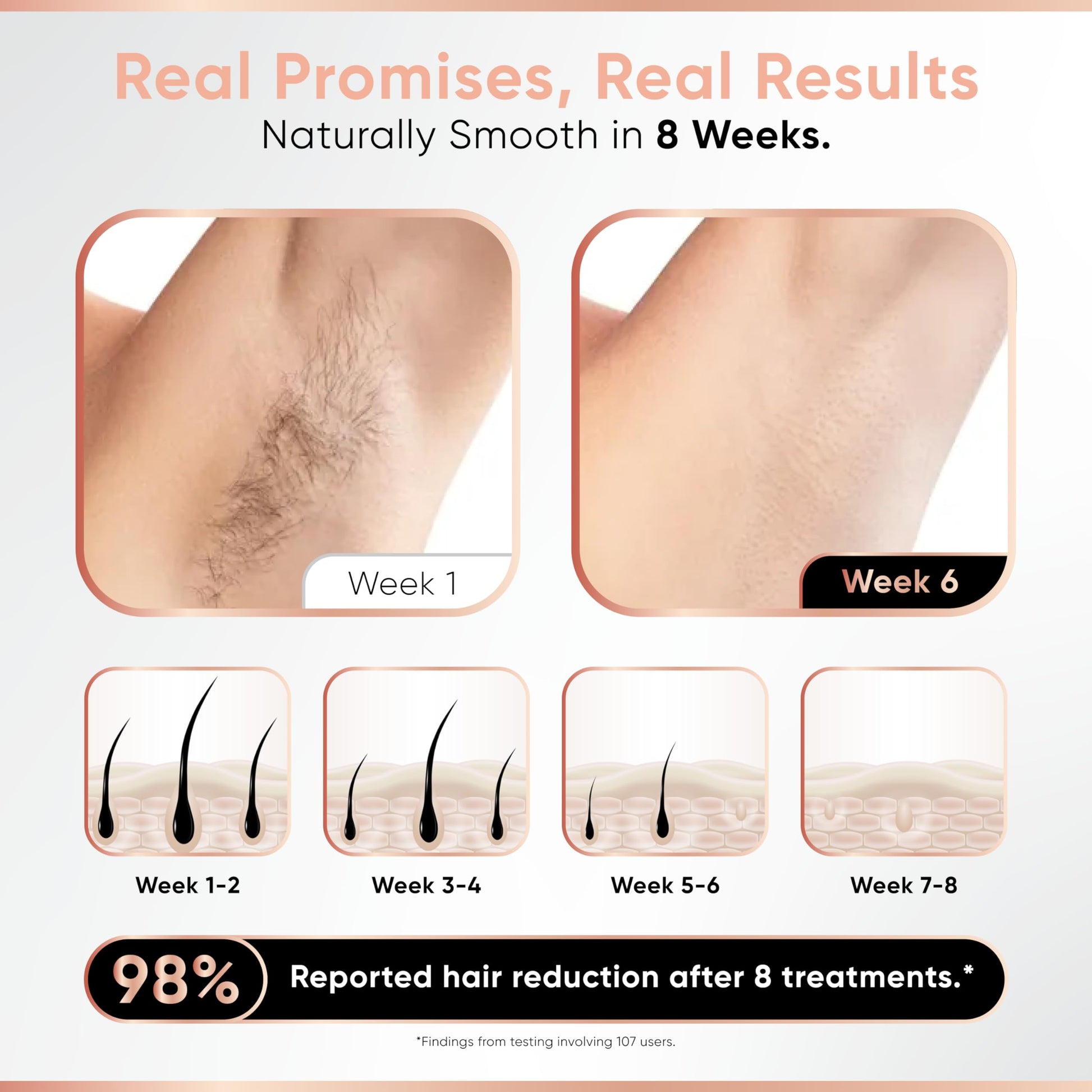 Depiladora Sensilight Mini Bronce para Mujer