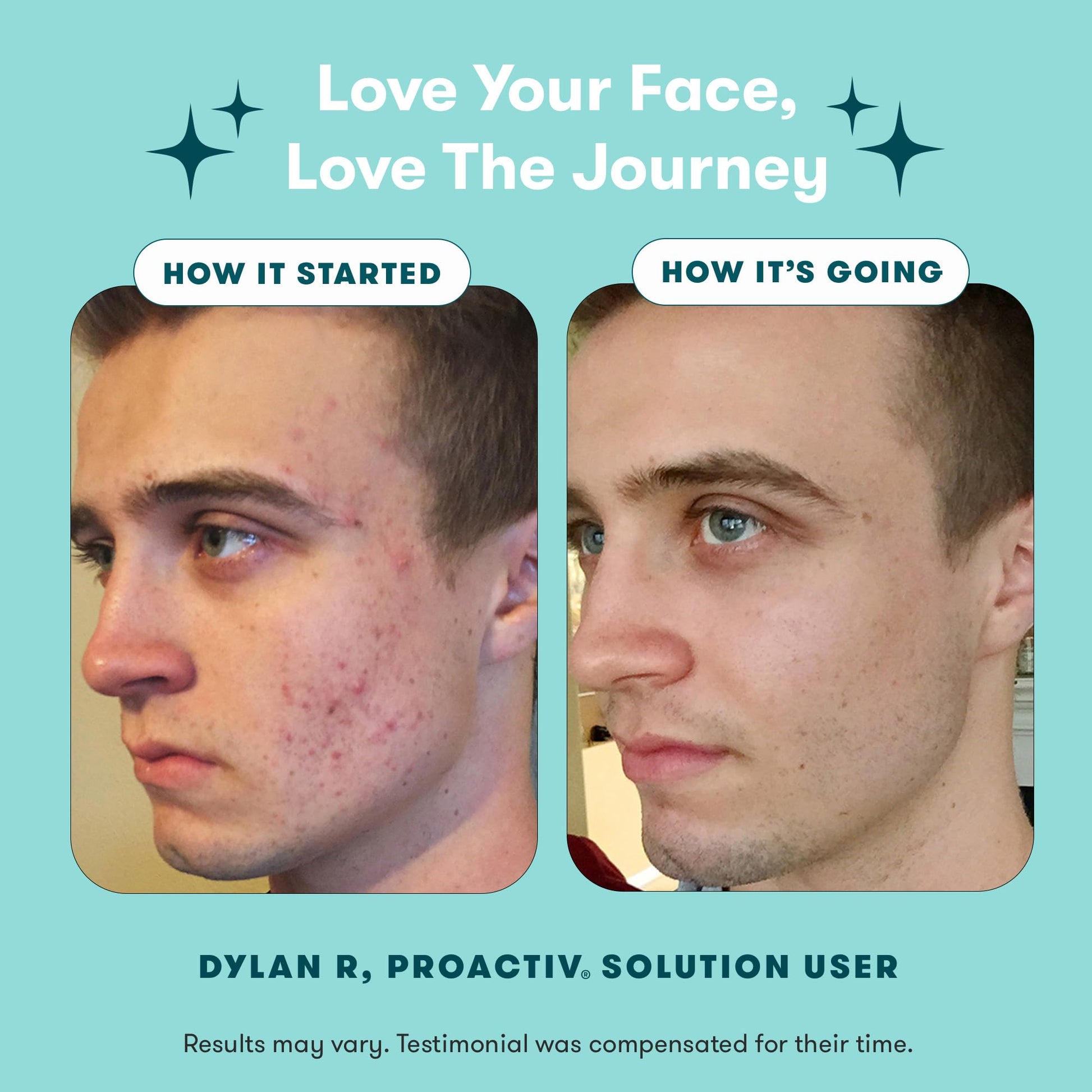 Kit de Inicio Sistema de Tratamiento para Acné Proactiv 3 Step