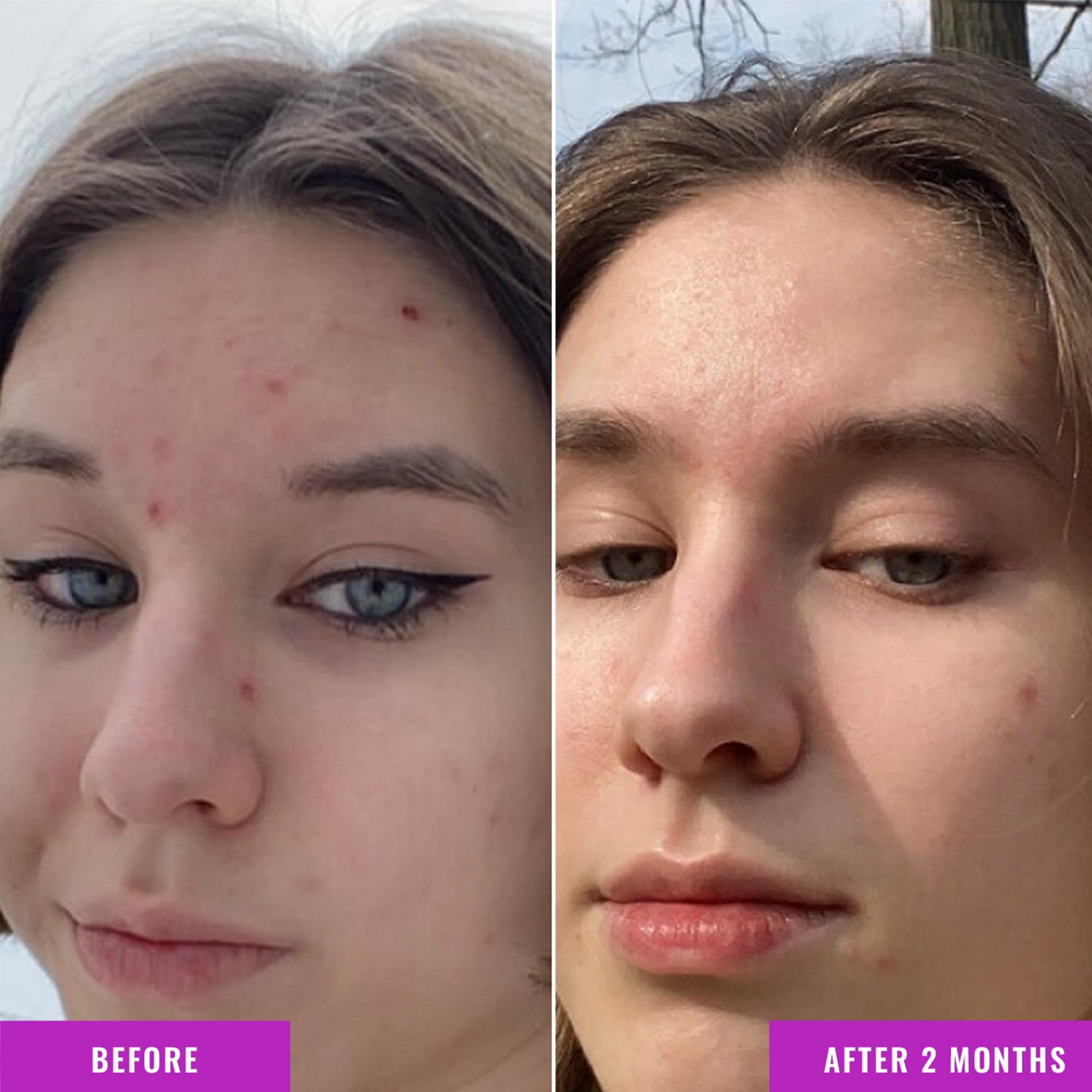 Good Molecules Niacinamide Serum 75ml - 10% Niamcinamide Balancing B3 Facial Serum for Acne, Enlarged Pores, Tone, Texture, Brightening, and Hydrating - Vegan, Cruelty Free and pH 7.1