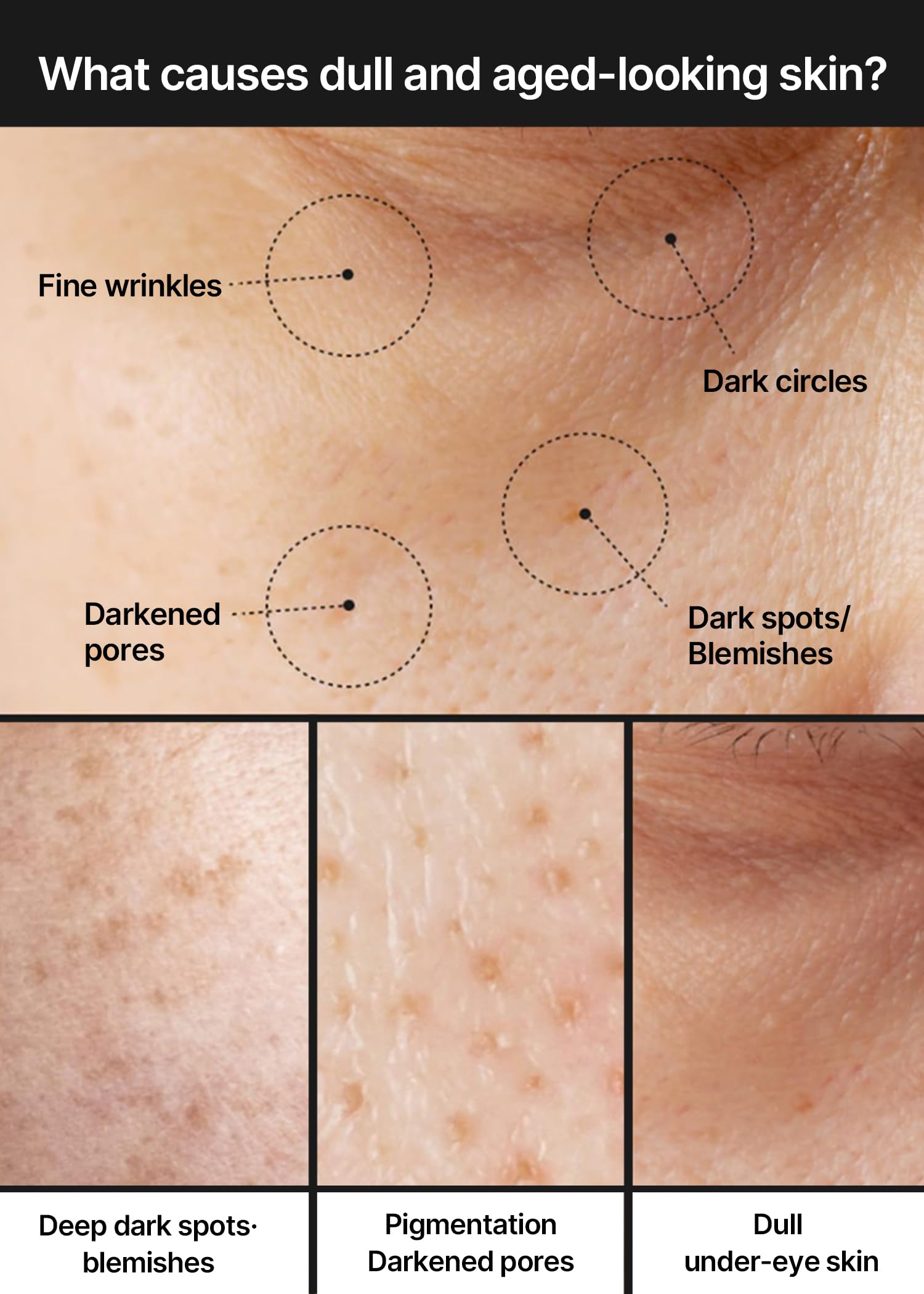 celimax Crema iluminadora de manchas oscuras Pore+, Con niacinamida, ácido tranexámico, crema TXA, minimizadora de poros, no irritante, hidratante, para pieles sensibles, crema de uso diario, 35 m