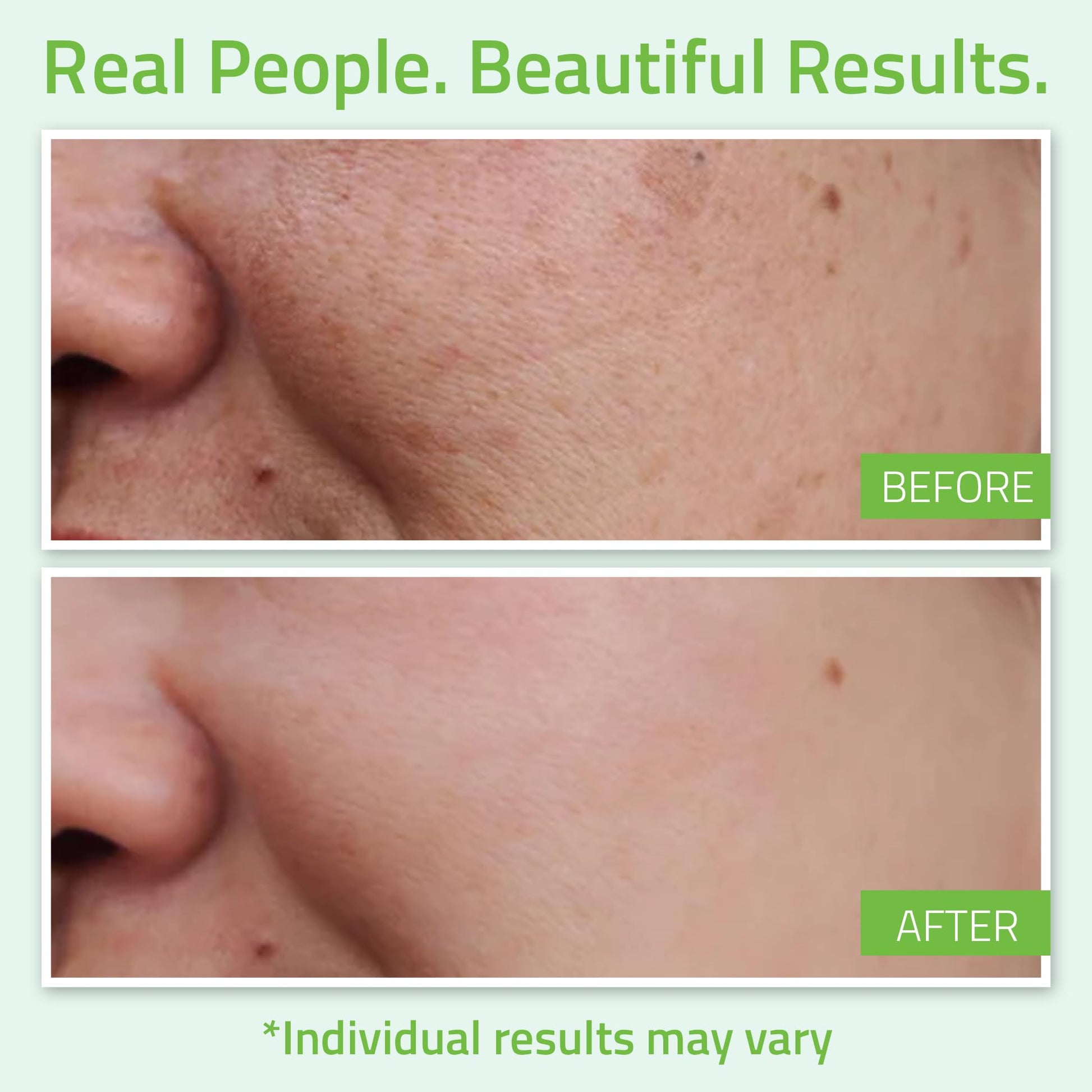 YEOUTH Serum Acido Hialuronico con Serum Vitamina C y Tripeptides, Ácido Hialurónico Cara para Hombres y Mujeres, Serum Facial para Arrugas, Puede Usar se con Retinol 30ml
