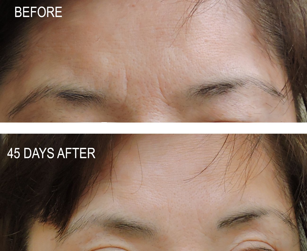 DNA Code DIY 100% Argireline Peptides Solution Add to Your Own Cream