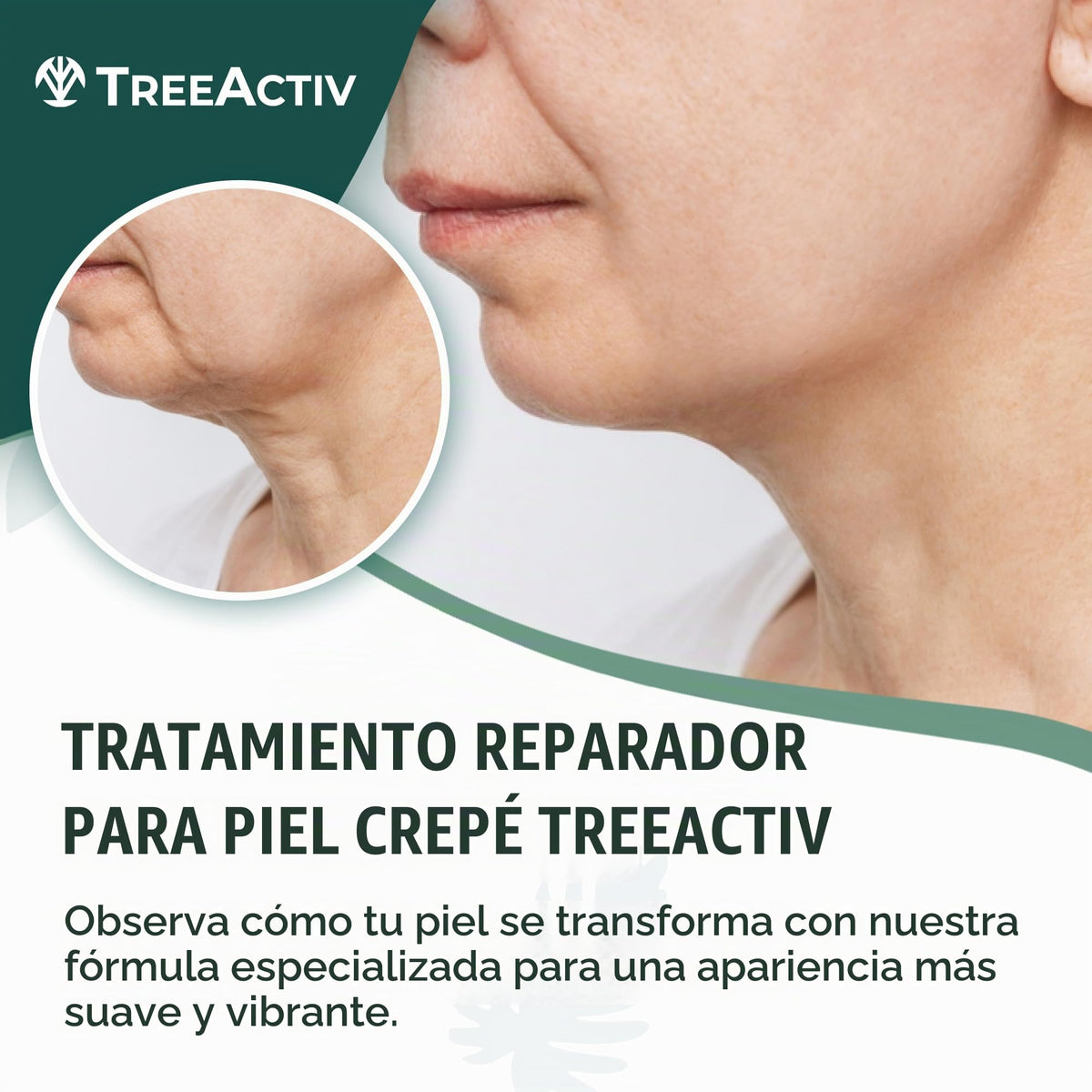 TreeActiv Crepey Skin Repair Treatment | Anti-Aging | Anti-Wrinkle | Organic Ingredients for Face, Neck, Chest, Legs & Arms | Hyaluronic Acid, Alpha Hydroxy Fruit Acids, Honey, Shea, Castor