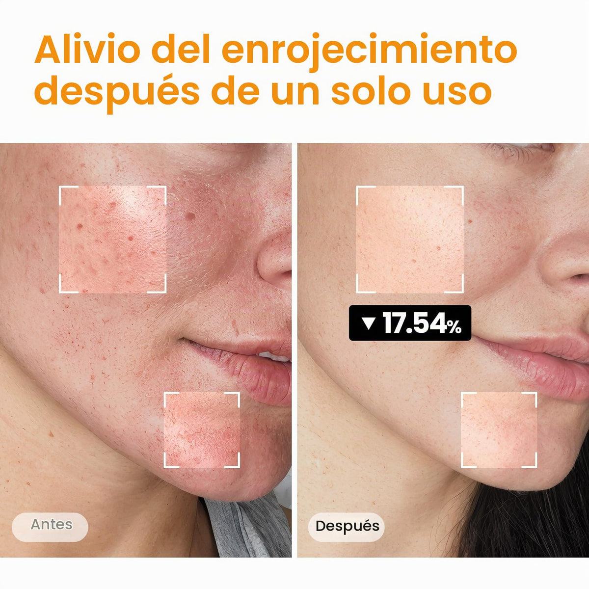 Almohadilla Calmante SKINFOOD Zanahoria para Piel Sensible Vegana
