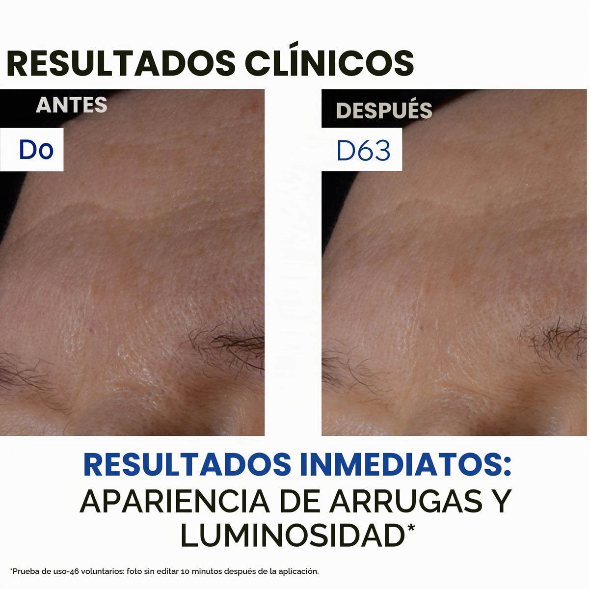 Uriage Age Absolu Mascarilla de noche reafirmante 50ml - con Retinol , Ácido Hialurónico y manteca de karité - Booster Procolágeno X6. Reduce visiblemente las arrugas. Textura fresca y ultra cómoda. Patente exclusiva antienvejecimiento