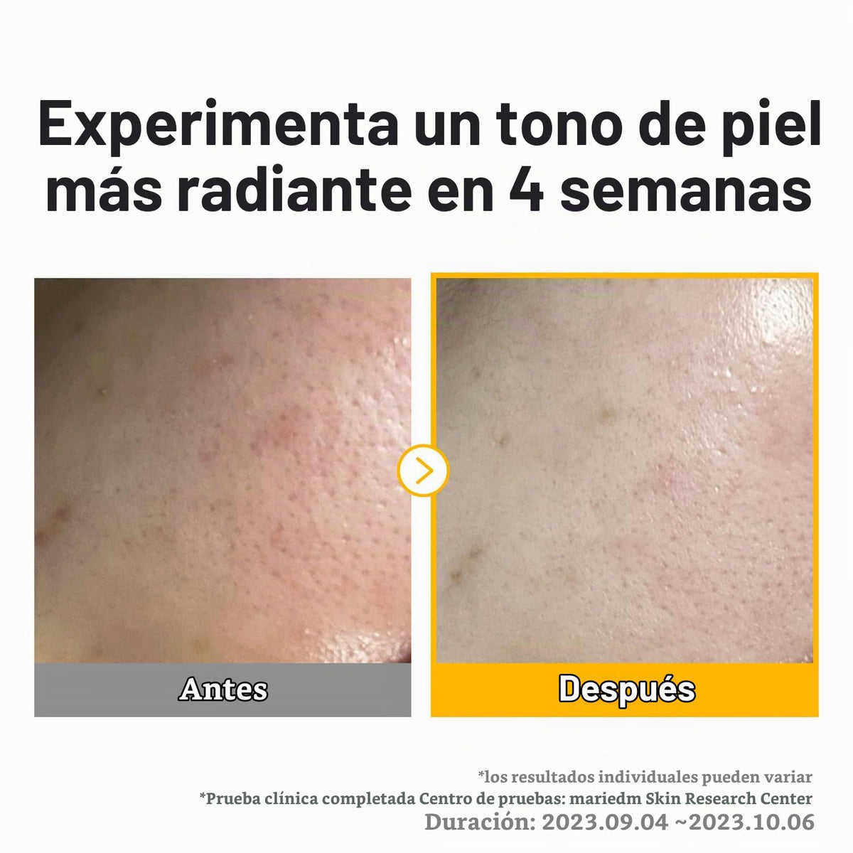 numbuzin Máscara de hoja No.5 | Máscara de lámina de foco de vitamina | Glutatión y vitamina C | Reduce la hiperpigmentación, mejora la tez de la piel | Suave y no irritante | 5 hojas