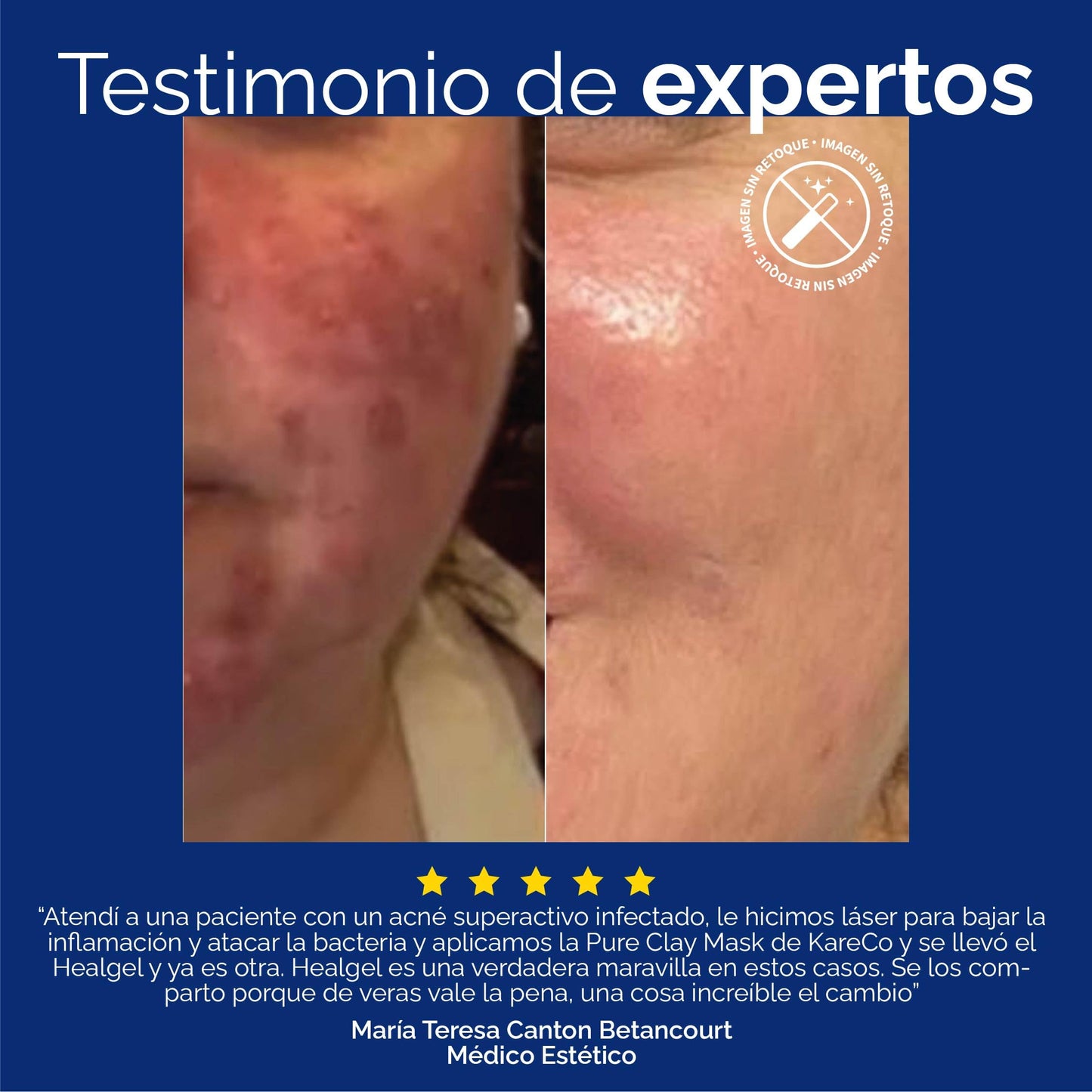 Käre Co HEALGEL RESTORATIVE gel hidratante facial | serum facial con niacinamida | no irritante que repara, hidrata y calma | logra una sensación de frescura y mejor apariencia | para tu skin care |