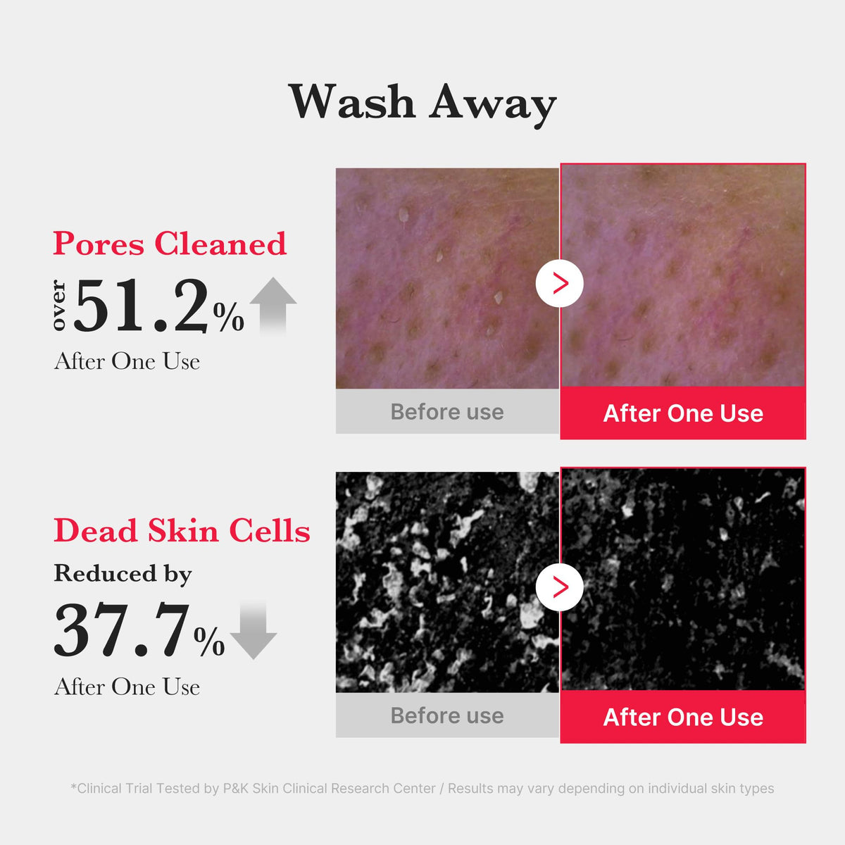MEDICUBE Red Foam Cleanser 2020, Limpiador Facial Coreano en Espuma con Ácido Salicílico 0.45%, para Exceso de Grasa, Poros y Textura, 120 ml