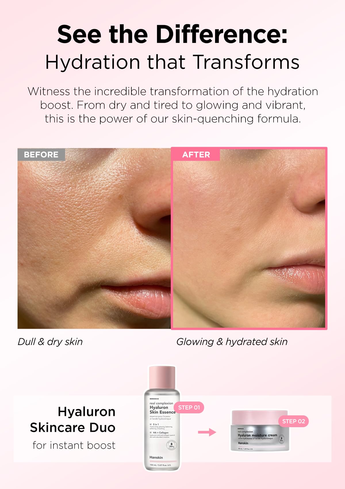 Hanskin Real Complexion Hialuron Skin Essence - Ácido hialurónico, hidratante, brillante, suave y sin fragancia [150 ml]