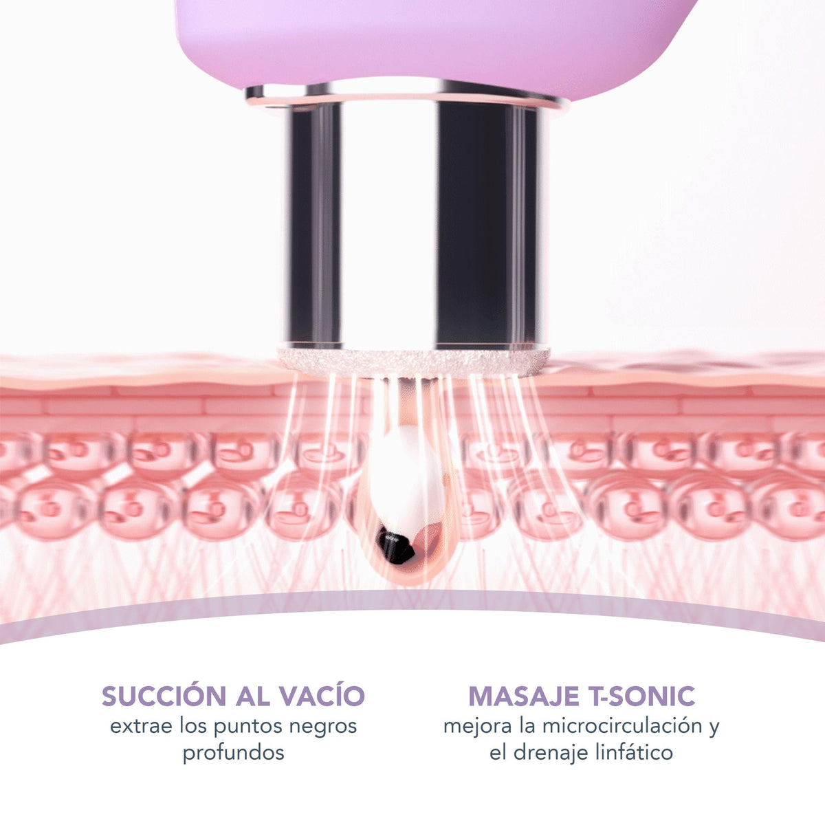FOREO KIWI DERMA Bundle – Microdermoabrasión con punta diamante – Limpiador facial eléctrico + LUNA Micro-Foam Cleanser 2.0 con ácido salicílico – Succionador puntos negros – Limpieza poros piel grasa