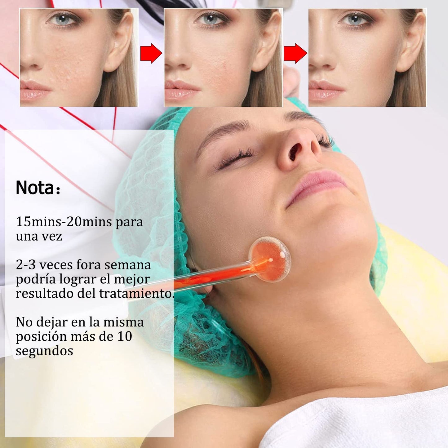 Máquina Facial De Alta Frecuencia,Equipo De Alta Frecuencia Para La Piel,máquina Portátil De Mano De Alta Frecuencia Para La Piel Facial Con 4 Tubos Diferentes