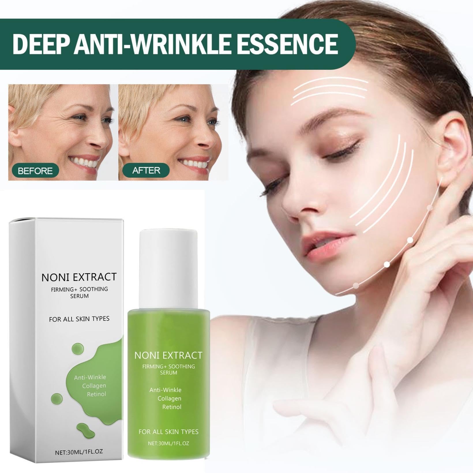 Suero Facial de Extracto de Noni, Retinol Antiarrugas y Energizante - Pack de 2 Unidades
