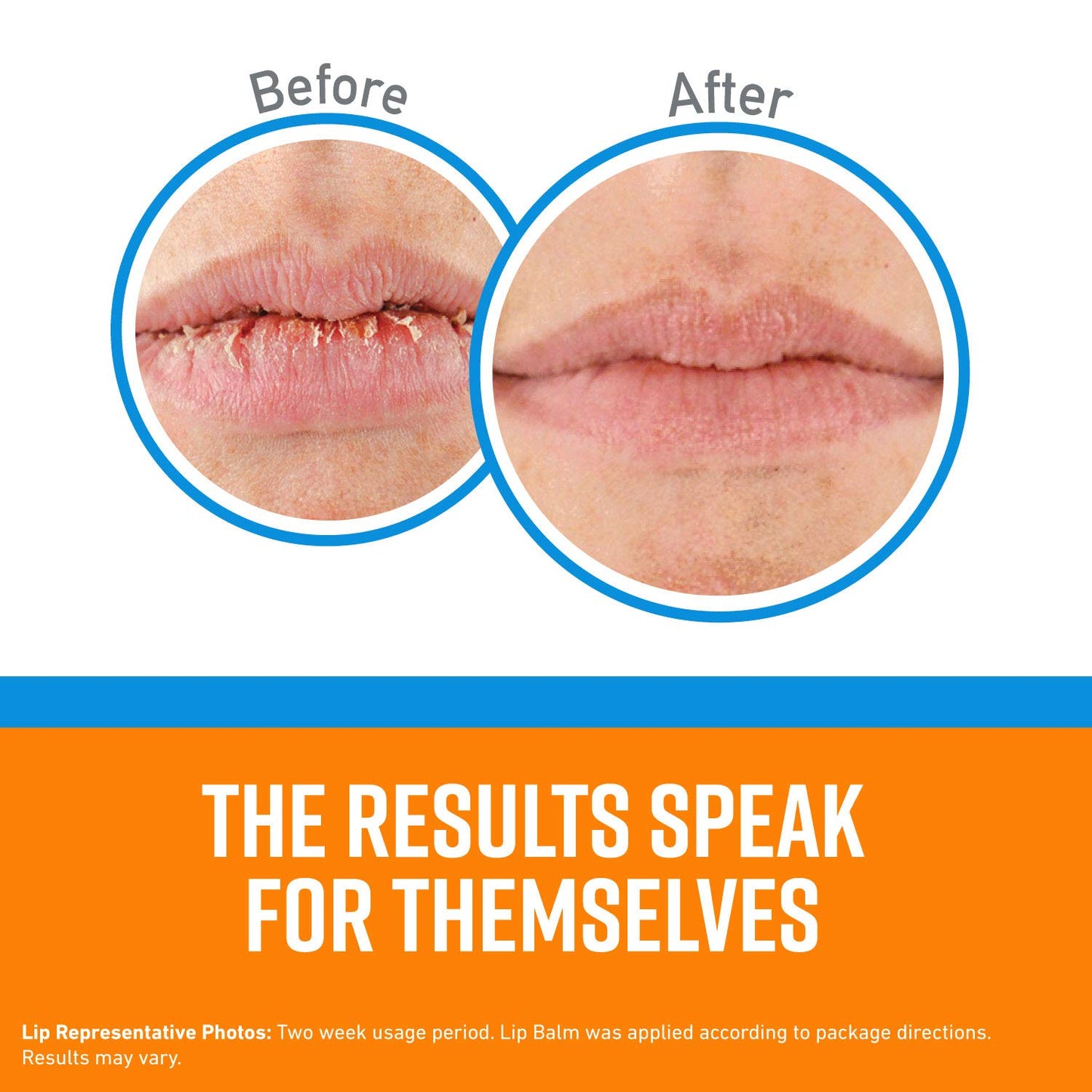 Lápiz de Reparación de Labios O'Keeffe's Refrigerante, 6 Unidades