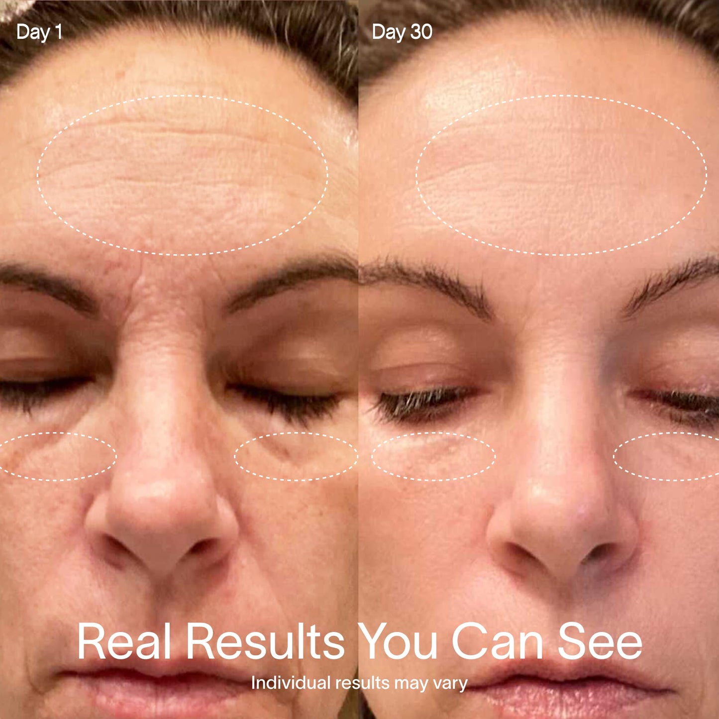 Varita de Renovación Radiante 4 en 1 Solawave azul rosa Ombre para el Cuidado de la Piel Facial