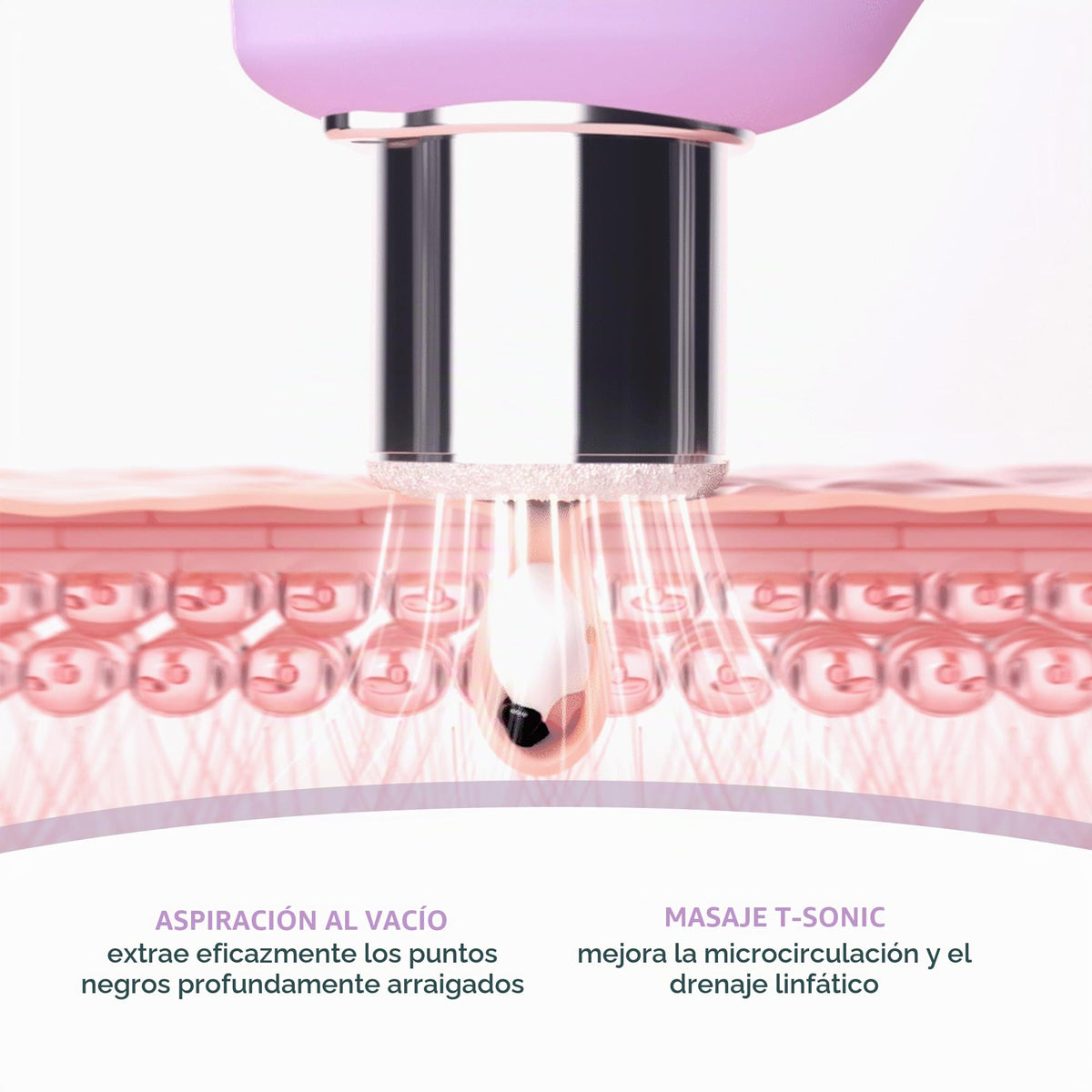 FOREO KIWI Derma– Limpiador facial electrico – Succionador puntos negros – Microdermoabrasion con punta de diamante – Eliminación granos e poros – Limpieza profunda poros