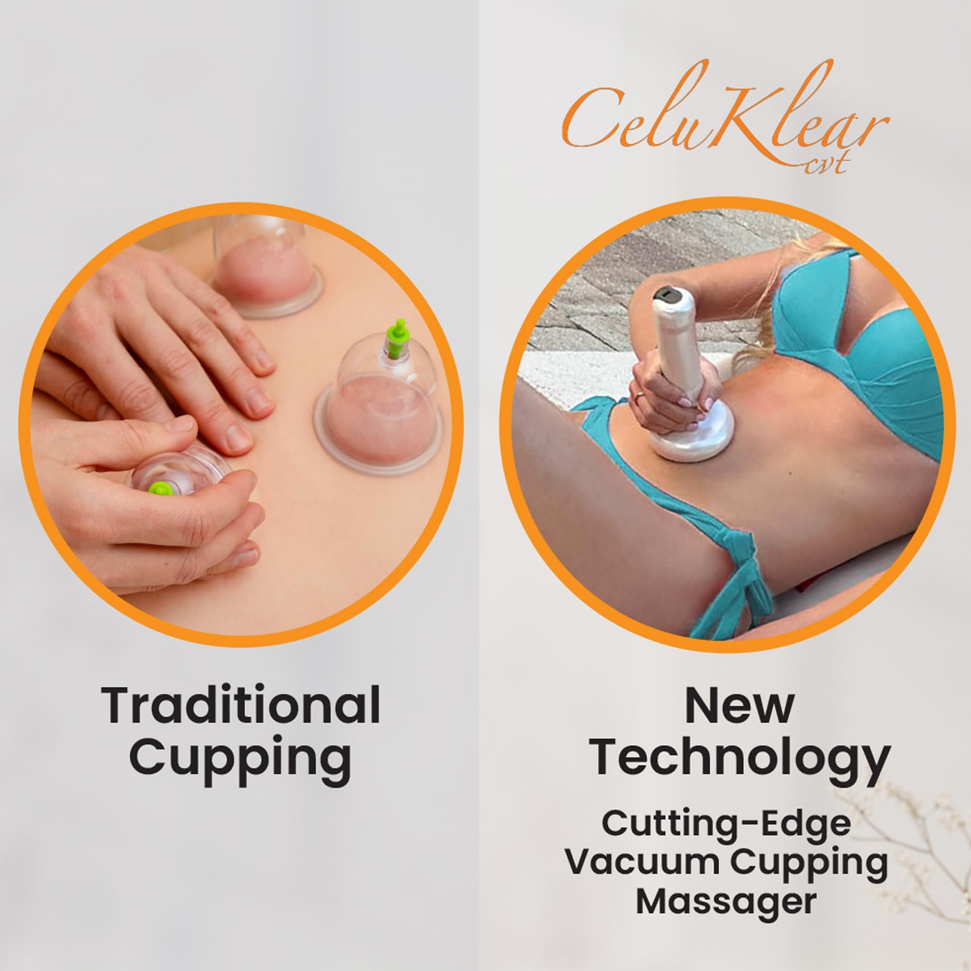 Nuflair Masajeador Eléctrico De Ventosas Celuklear Cvt 3 En 1: Máquina De Ventosas Para Celulitis, Masaje De Tejido Profundo Y Drenaje Linfático. Succión Ajustable Que Favorece La Circulación Y La Sal