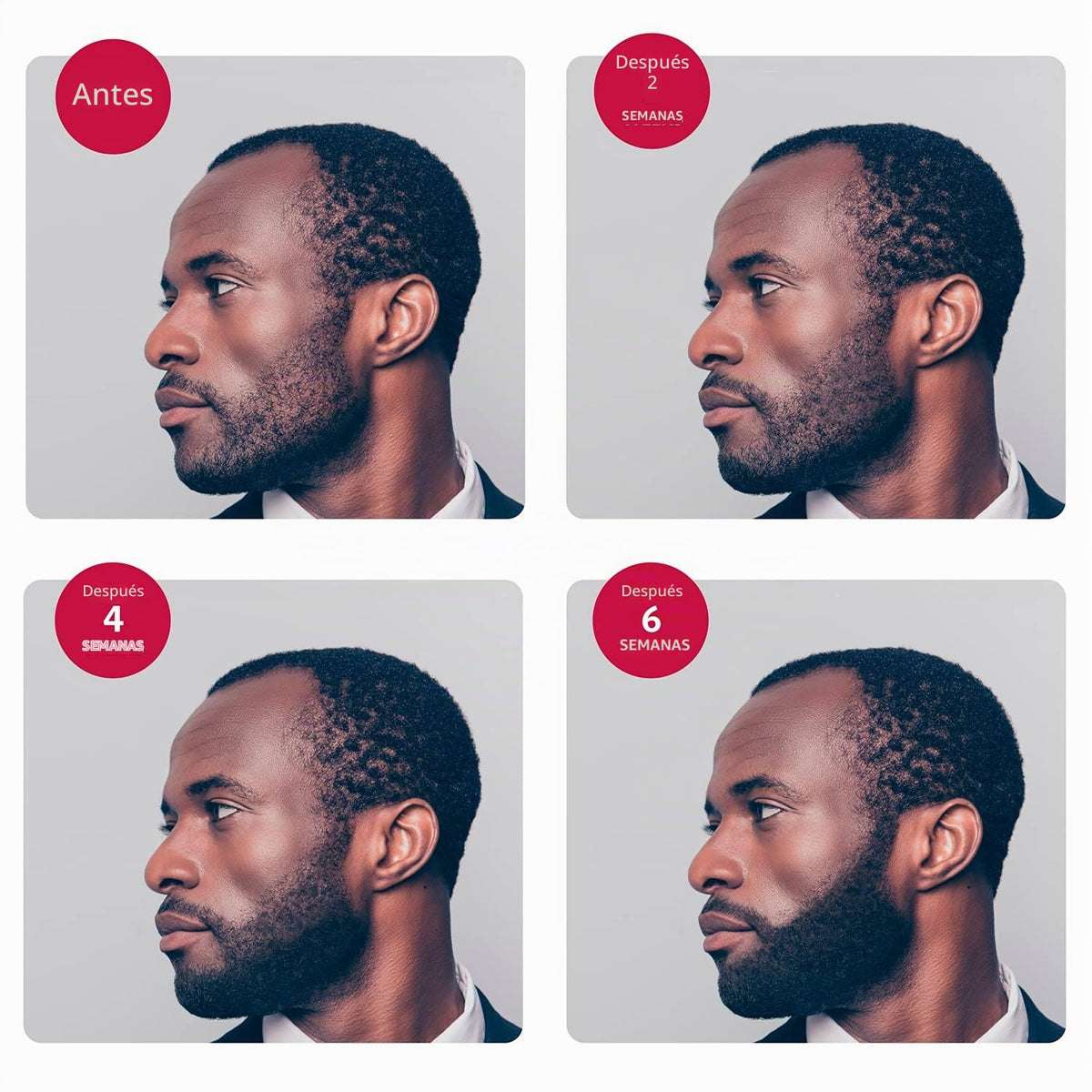 Suero para Crecimiento de Barba y Bigote Godefroy 15 ml para Tipos de Cabello Étnico