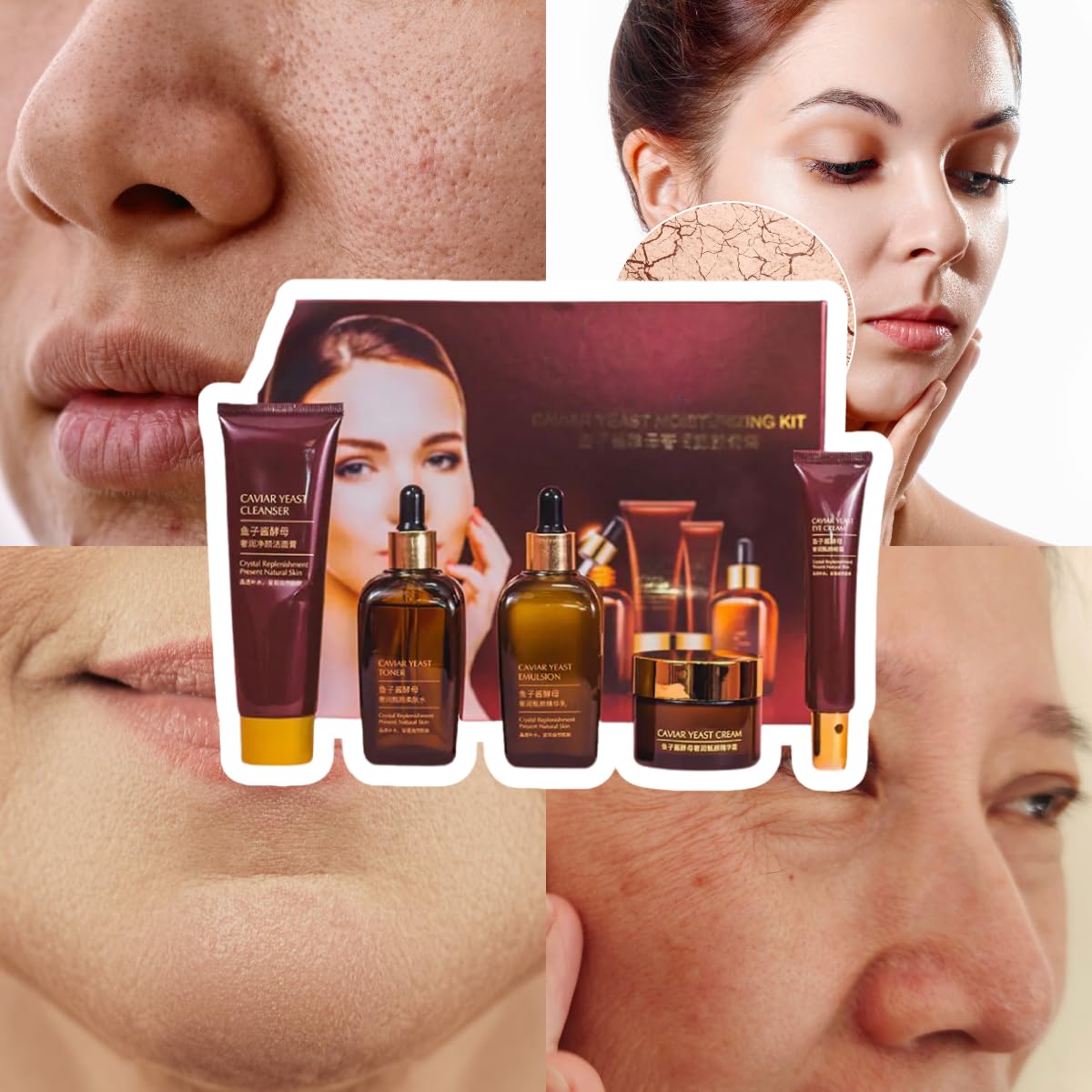 UNIVERSOENLÍNEA.COM Set 5 Piezas Cuidado Facial Caviar Yeast Moisturizing Kit Rutina Facial Coreana Completa Piel Reseca Extracto Caviar Acido Hialuronico Anti Arrugas Lineas de Expresion