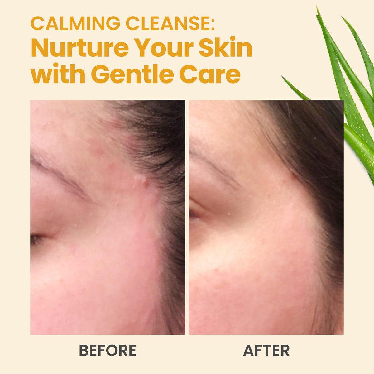 Gentle Moisturizing Organic Face & Body Wash (4 oz) Manuka Honey, Eczema, Psoriasis, Acne, Rosacea, Aloe Vera, Botanicals, No Parabens, No Sulfates, No Fragrance, Non-Allergenic by Honeyskin
