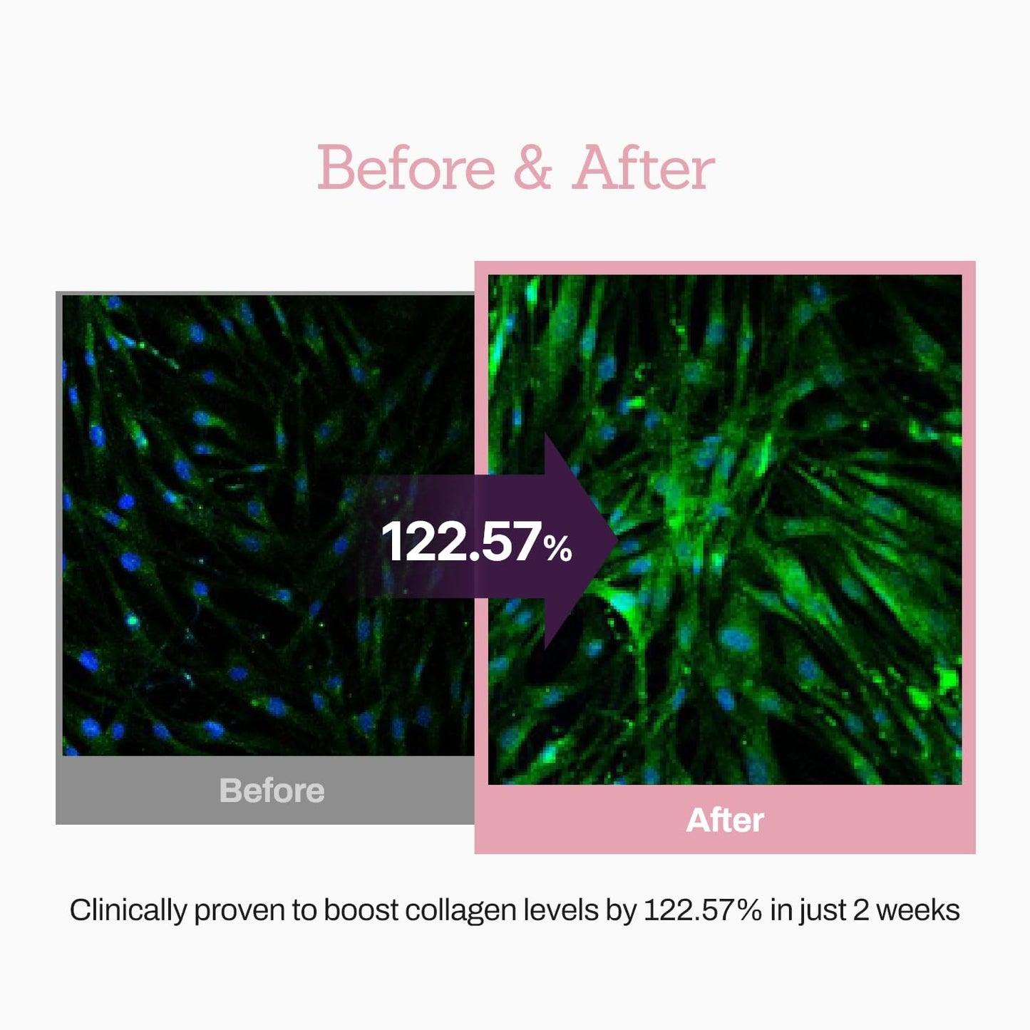 MEDITHERAPY Suero potenciador de péptidos de colágeno 12X, mejora la elasticidad de la piel y reduce las arrugas profundas, promueve la producción de colágeno para una piel firme y joven, cuidado de