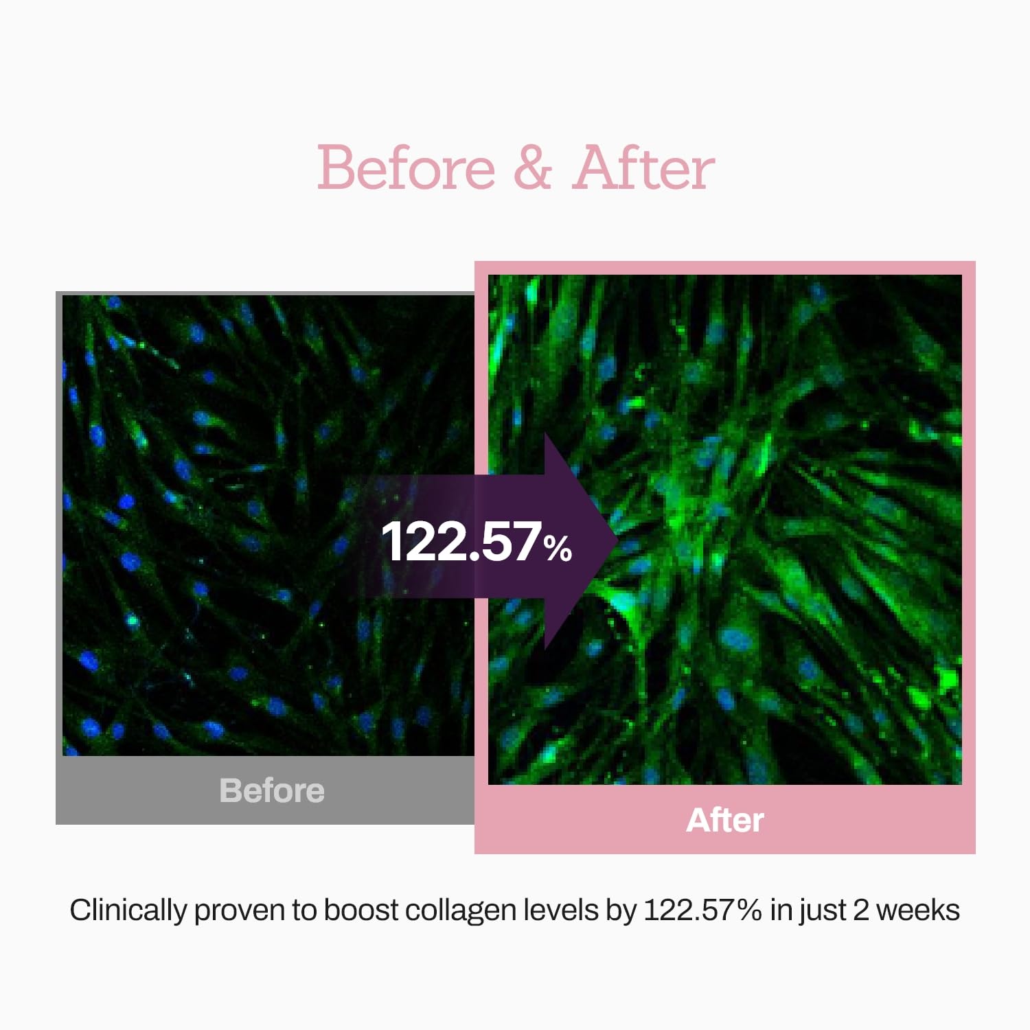 MEDITHERAPY Suero potenciador de péptidos de colágeno 12X, mejora la elasticidad de la piel y reduce las arrugas profundas, promueve la producción de colágeno para una piel firme y joven, cuidado de