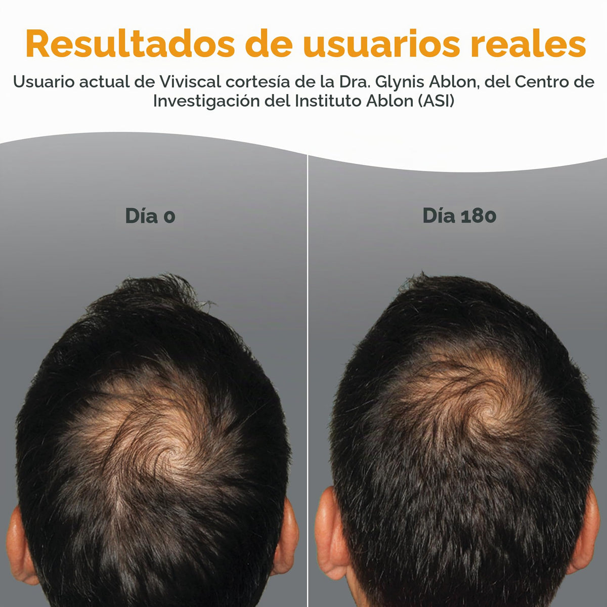 Suplementos para Crecimiento Capilar de Viviscal Hombre con Complejo de Colágeno Propietario, 60 Tabletas para Cabello Más Grueso y Abundante